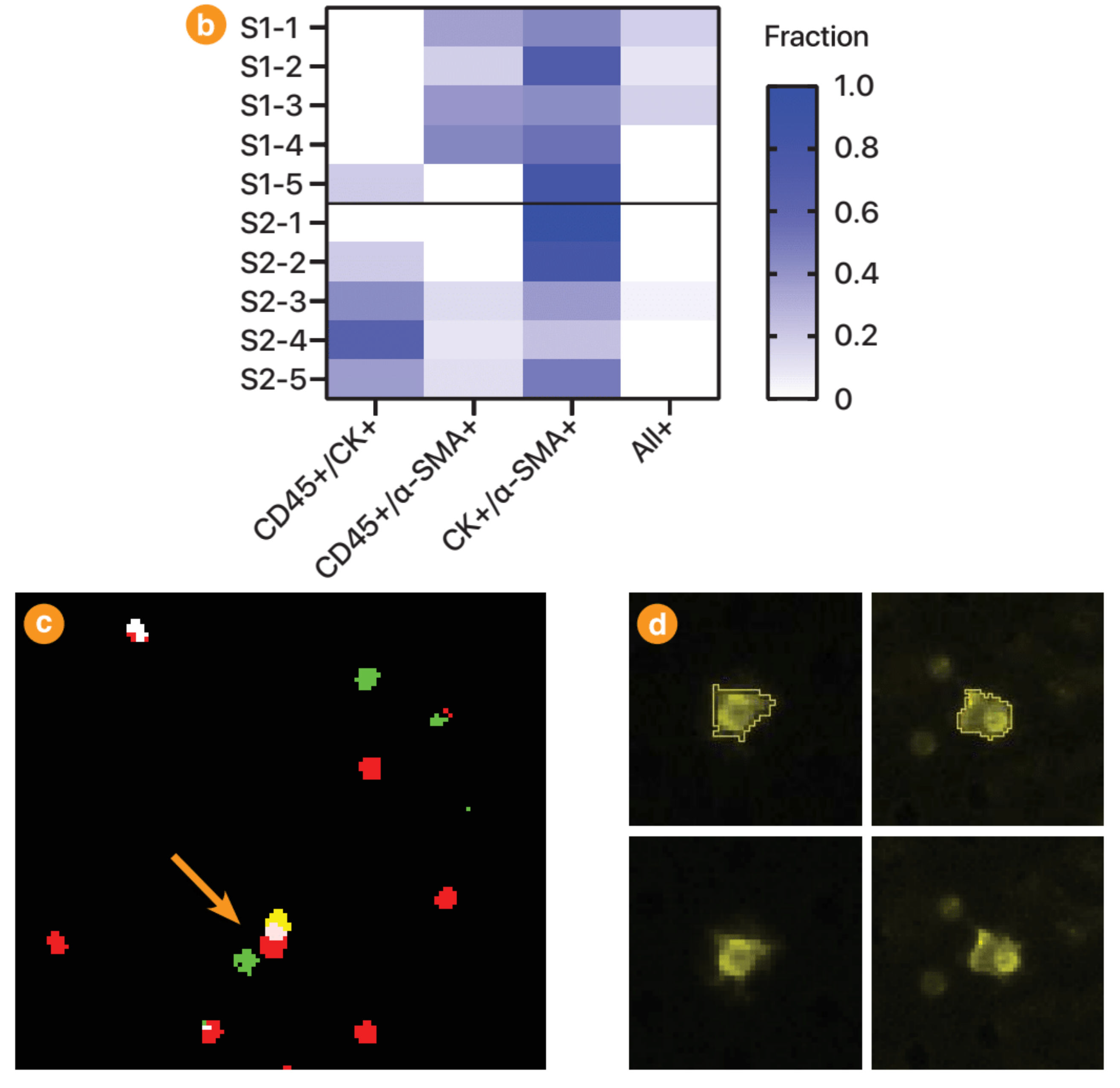 Cancers 13 02763 g0a4b Cancers 13 02763 g0a4b