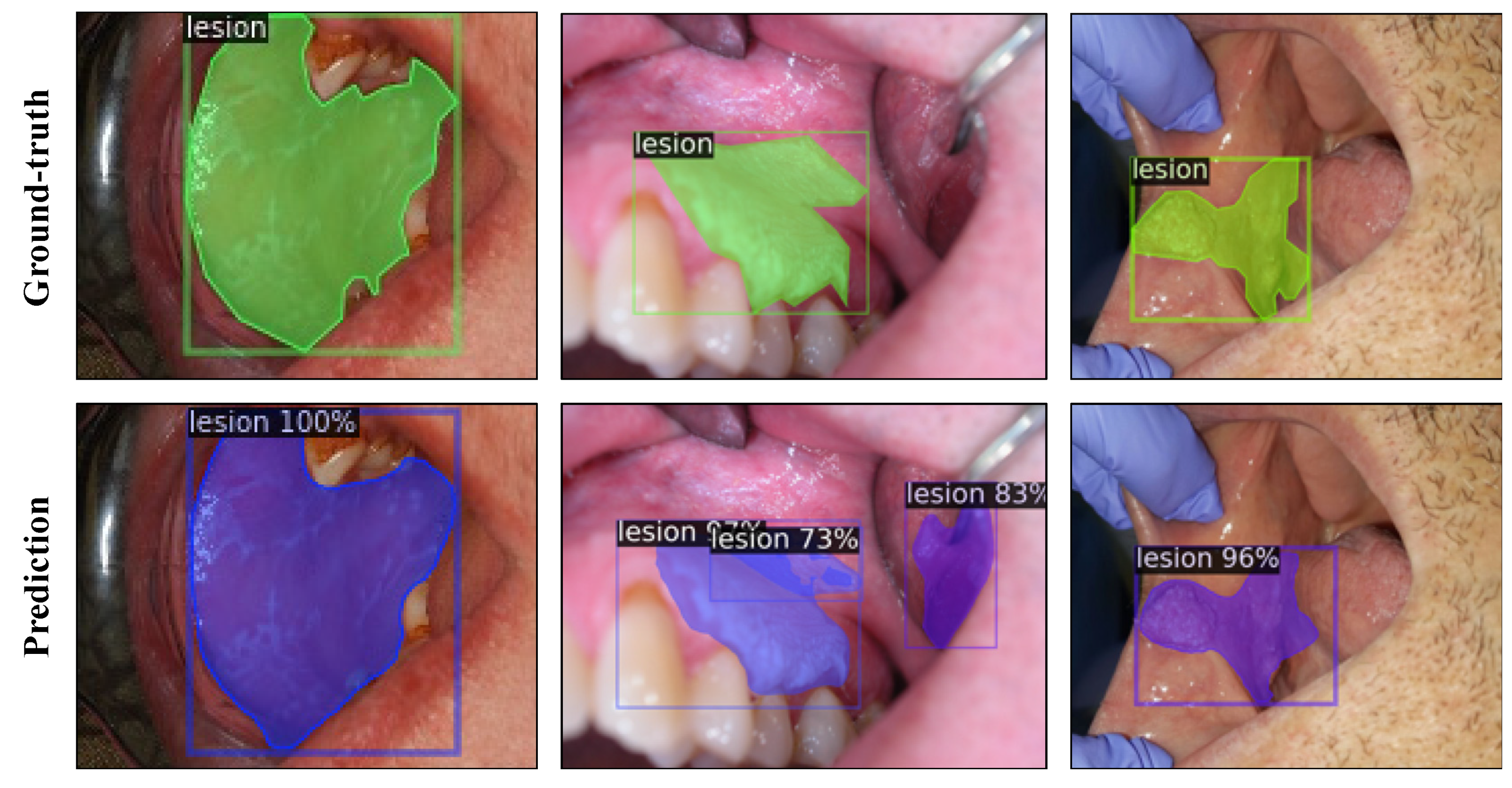 Cancers 13 02766 g003