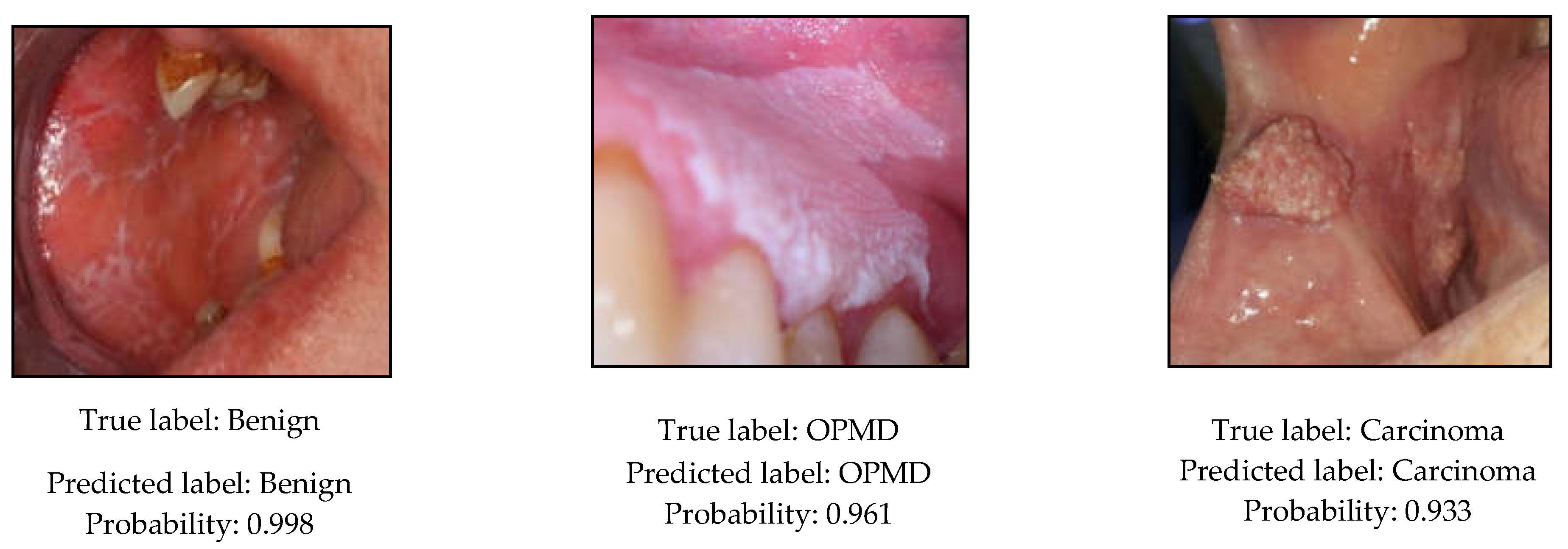 Cancers 13 02766 g006