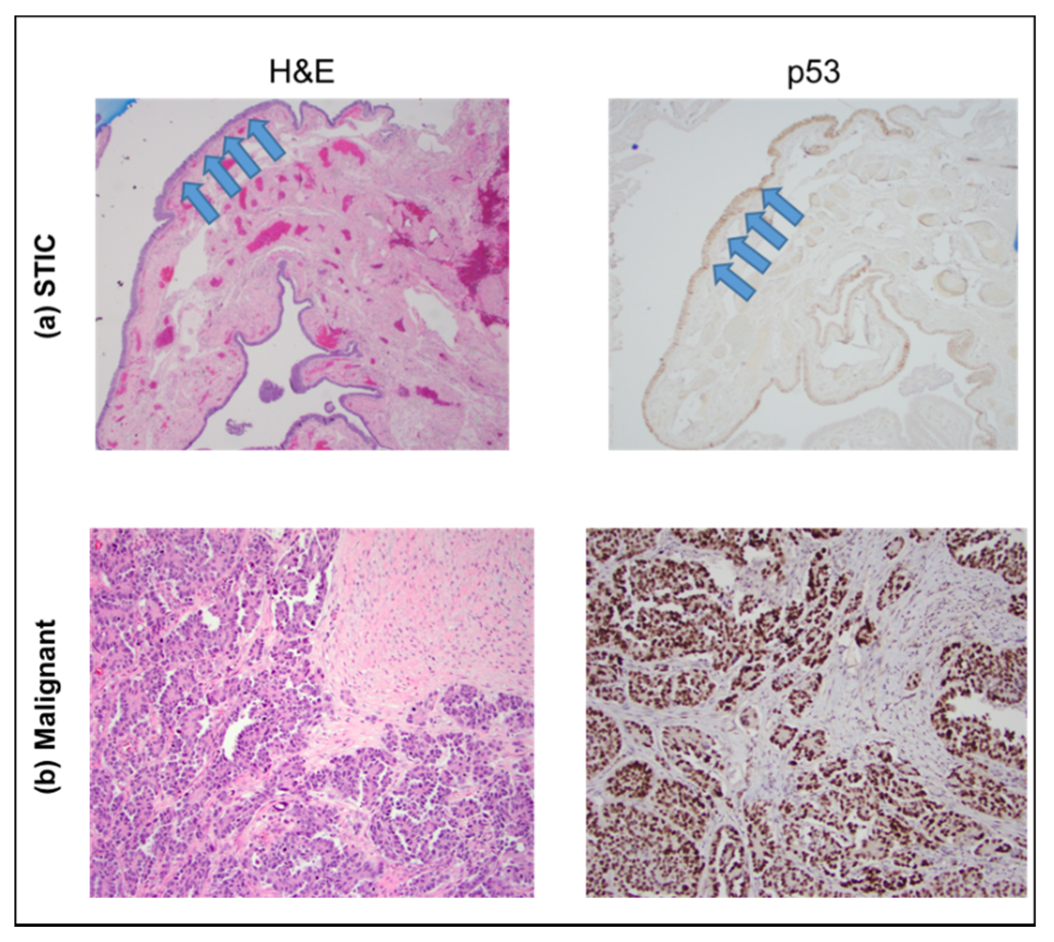 Cancers 13 02794 g002 Cancers 13 02794 g002