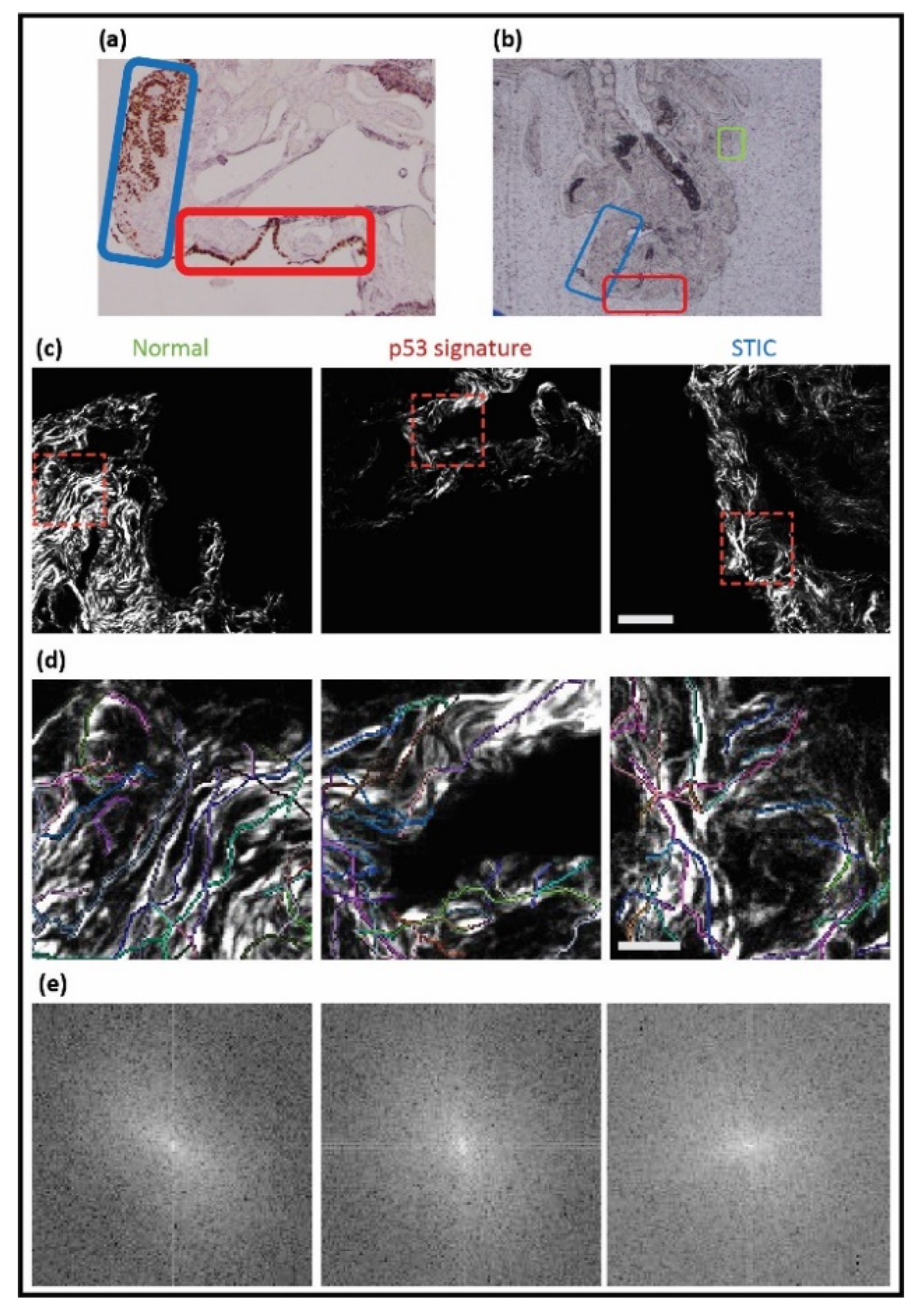 Cancers 13 02794 g003 Cancers 13 02794 g003