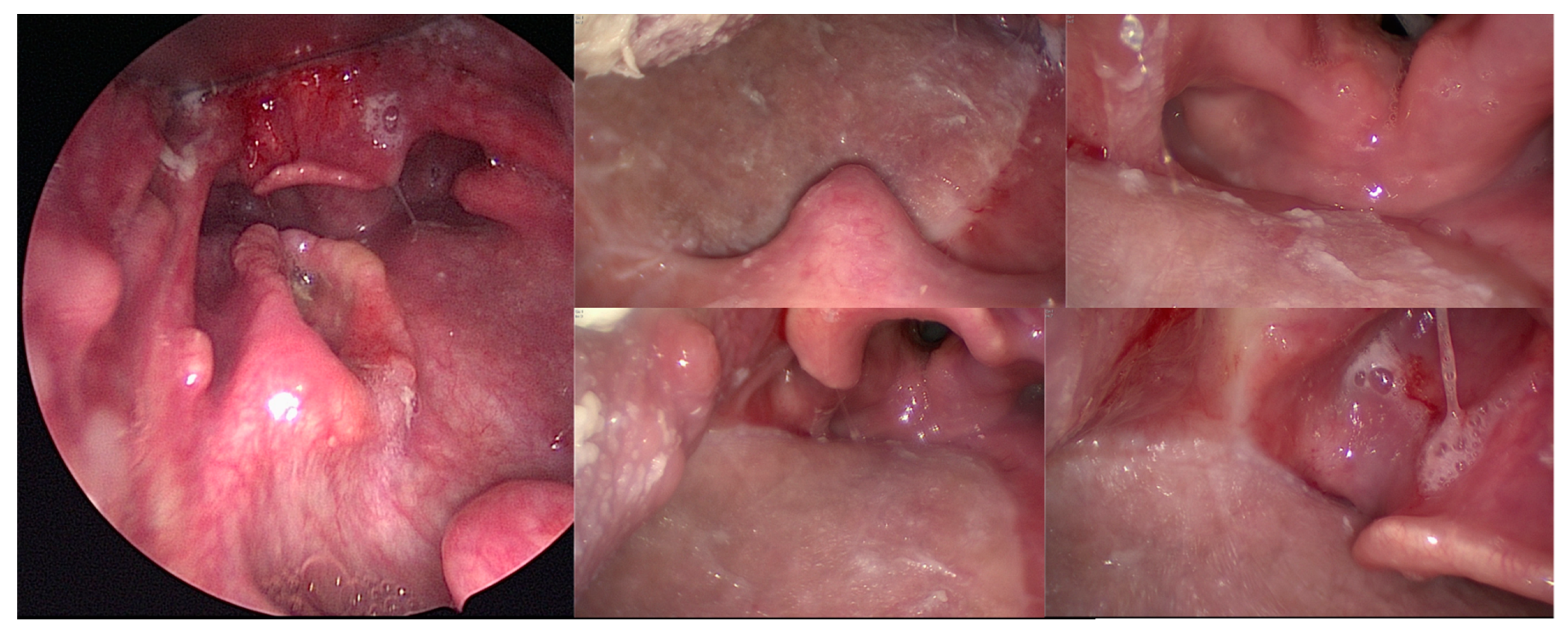 Cancers 13 02831 g002 Cancers 13 02831 g002