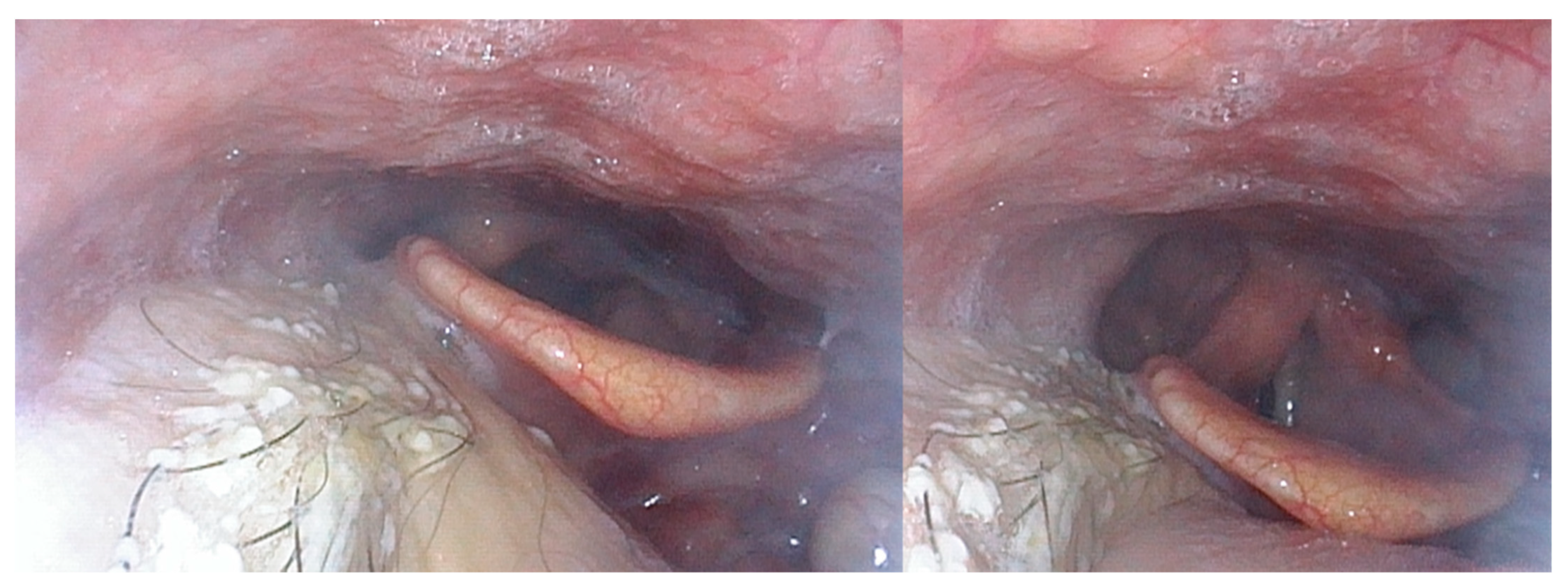 Cancers 13 02831 g003 Cancers 13 02831 g003