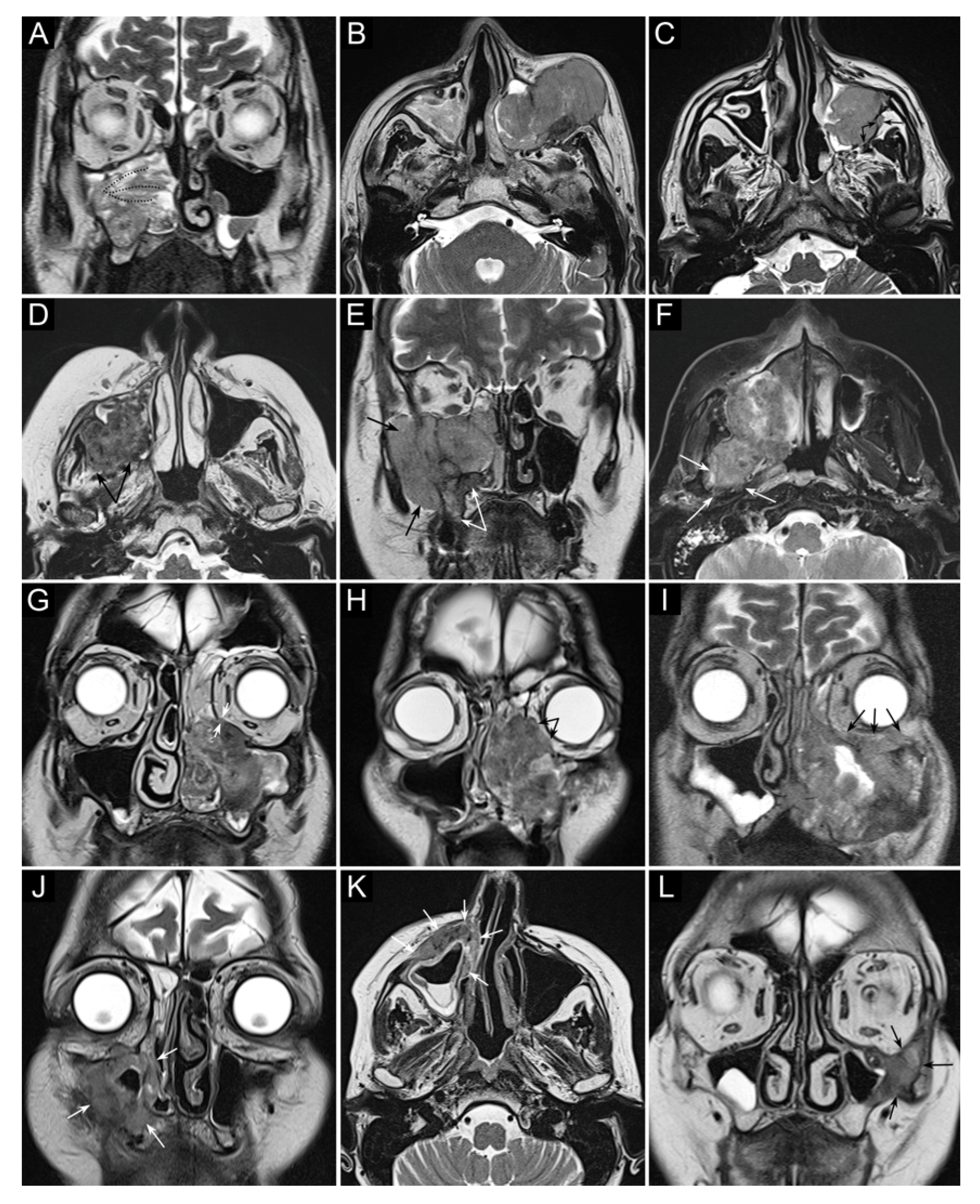 Cancers 13 02835 g002 Cancers 13 02835 g002