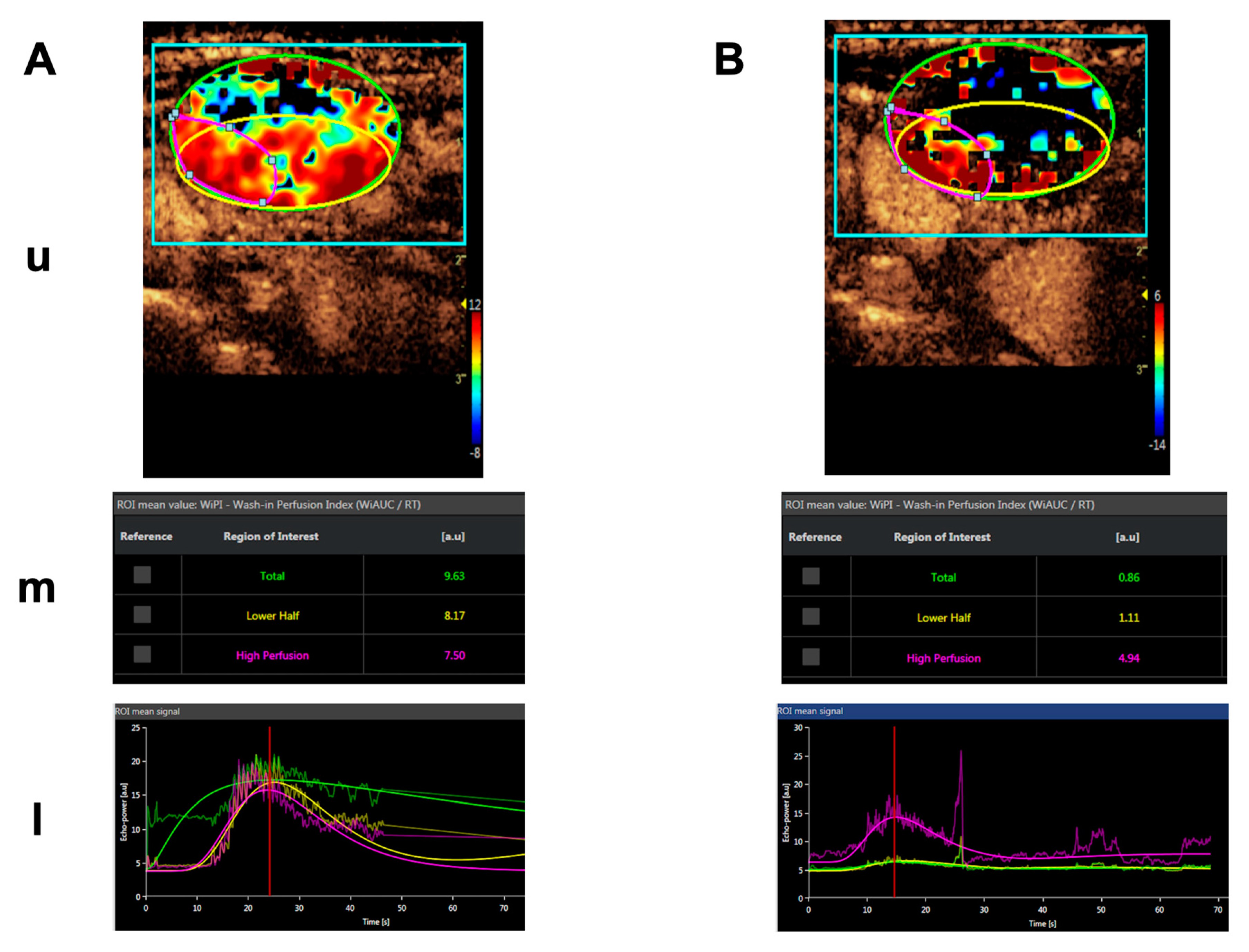 Cancers 13 02841 g004