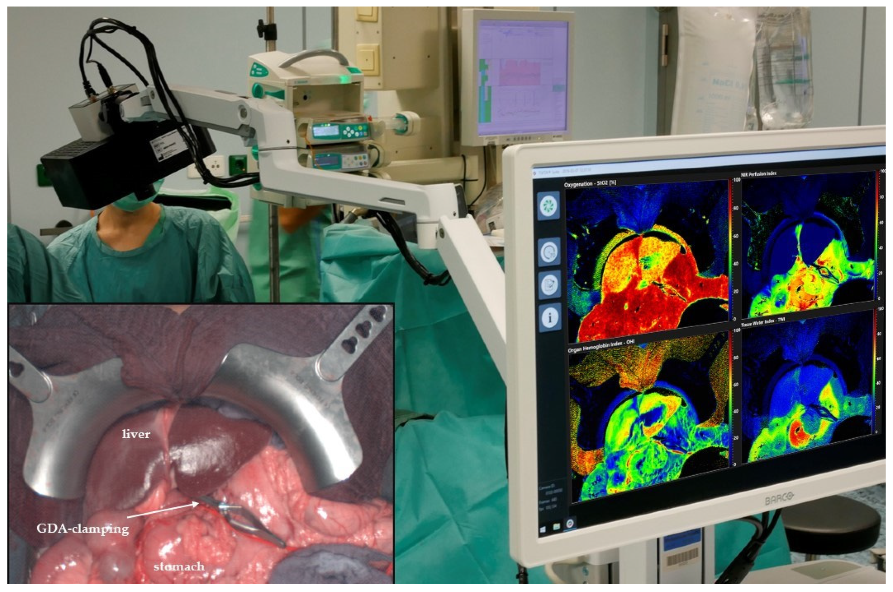 Cancers 13 02846 g001 Cancers 13 02846 g001