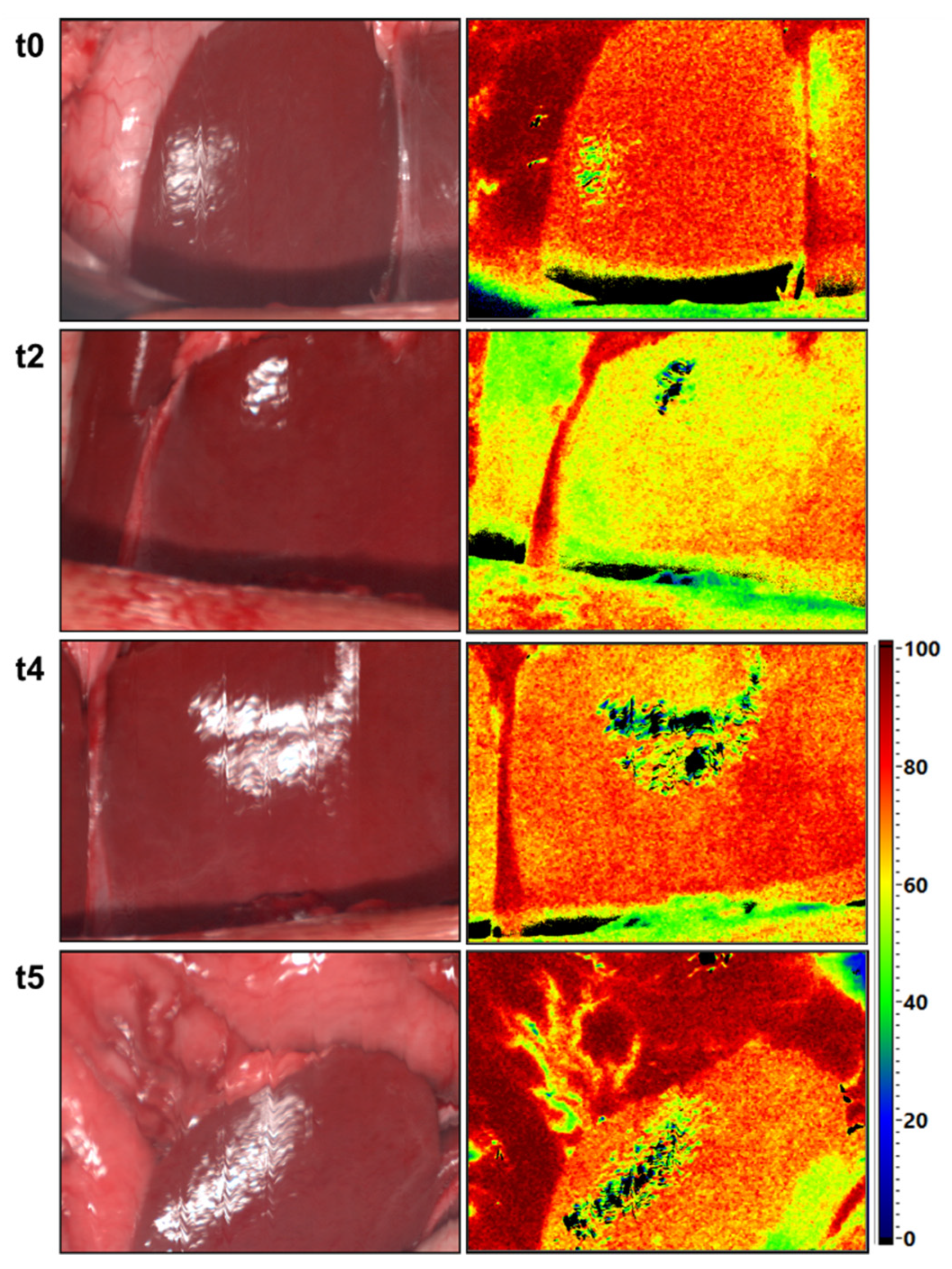 Cancers 13 02846 g008 Cancers 13 02846 g008