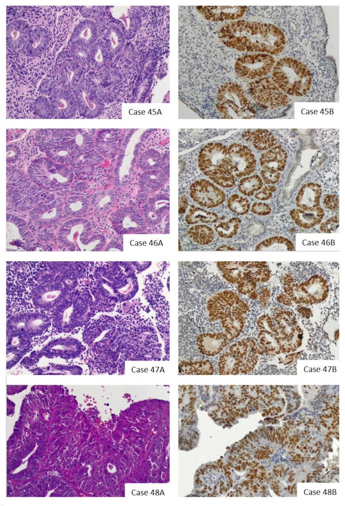 Cancers 13 02847 g002