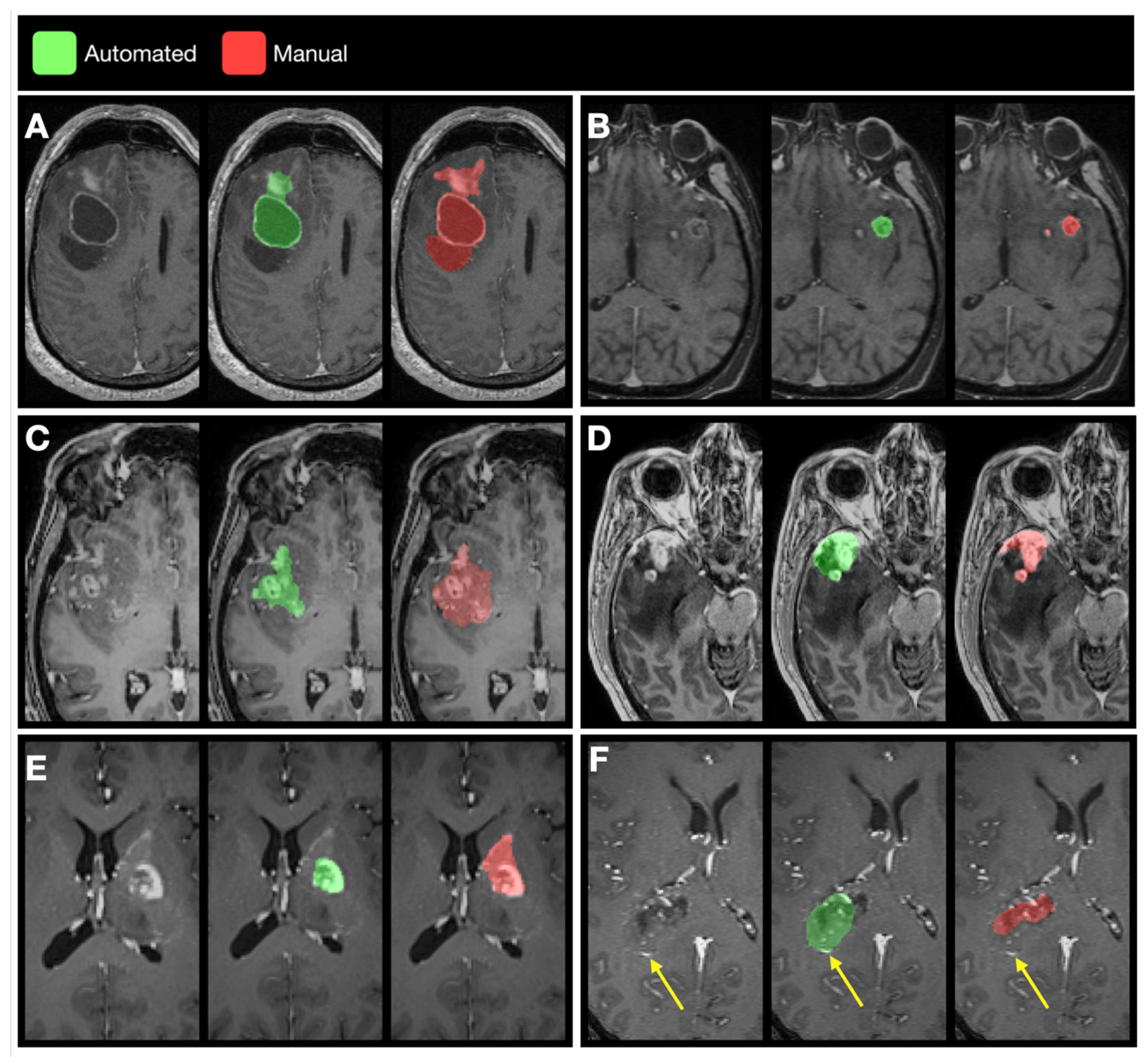 Cancers 13 02854 g008 Cancers 13 02854 g008