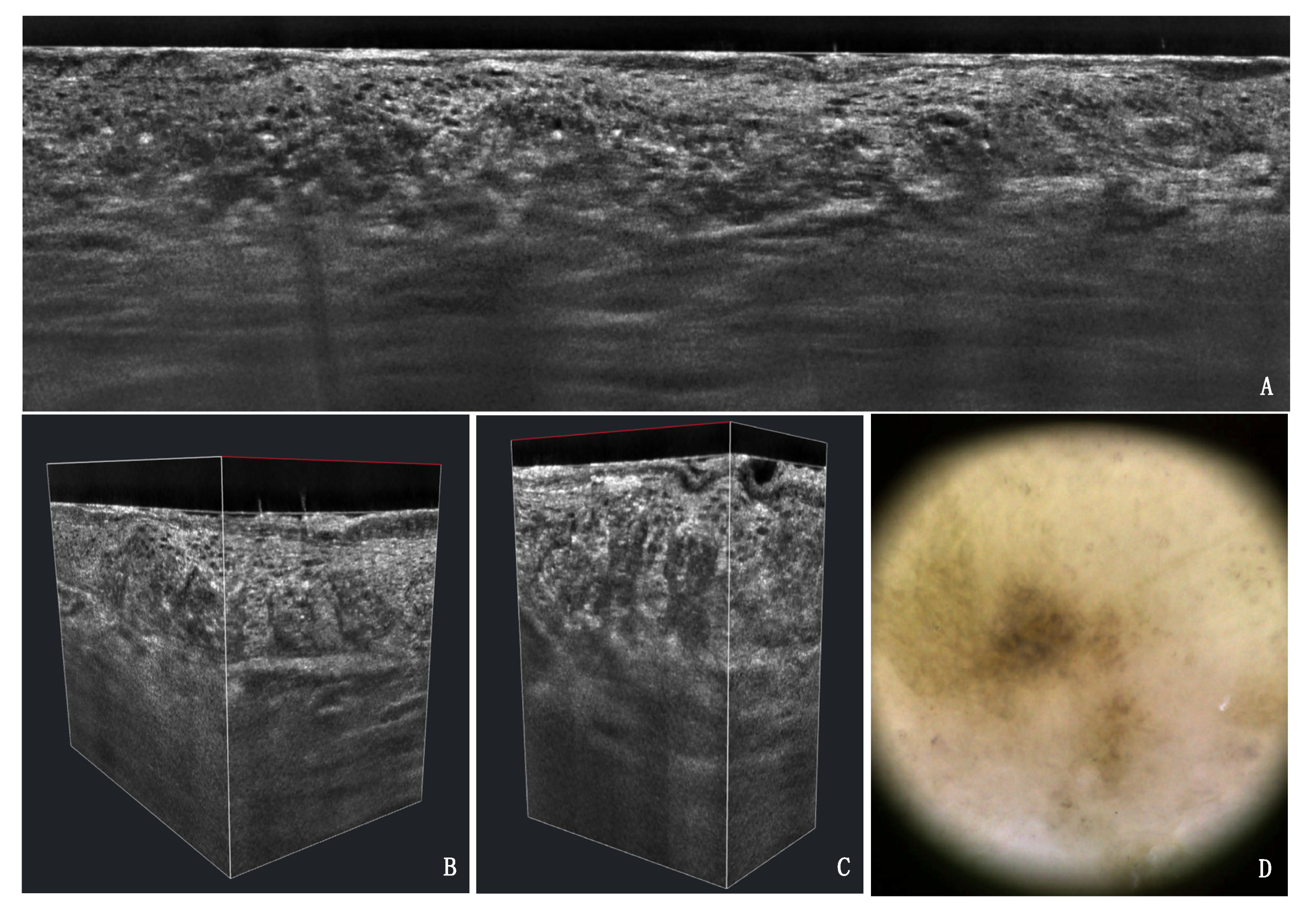 Cancers 13 02856 g005