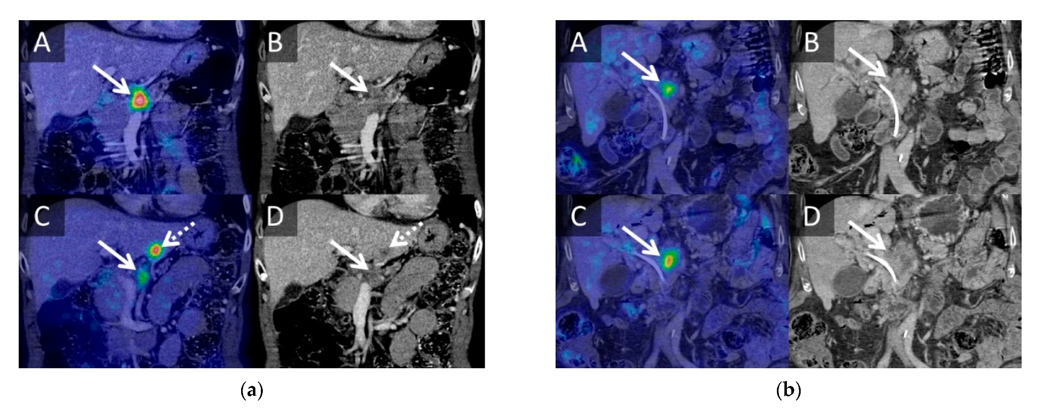 Cancers 13 02862 g001 Cancers 13 02862 g001