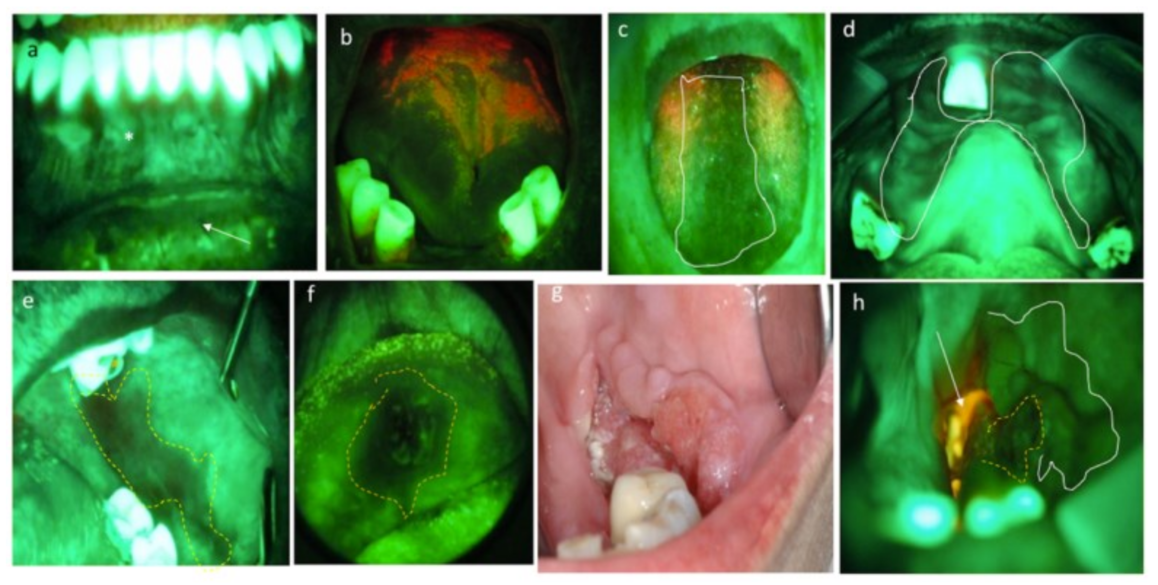 Cancers 13 02864 g002