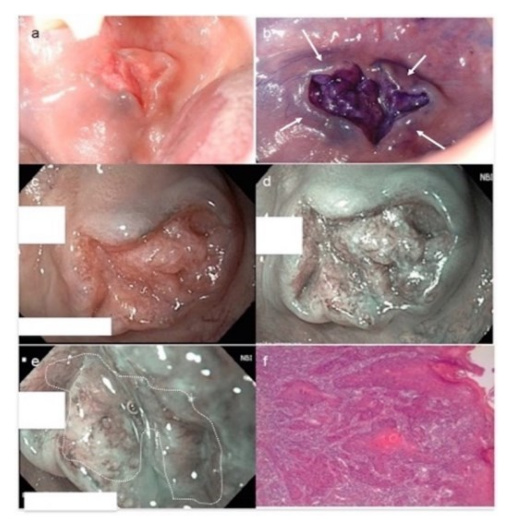 Cancers 13 02864 g004