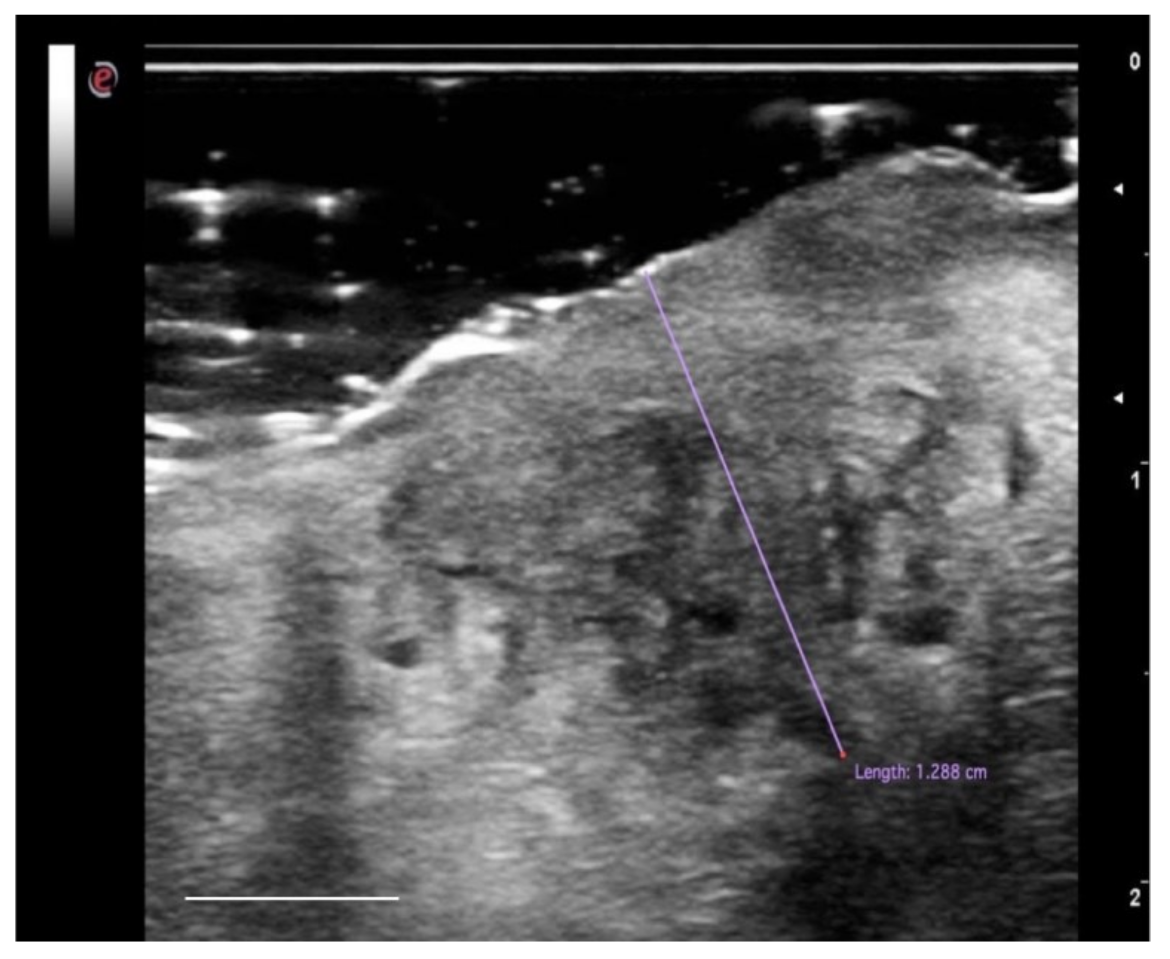 Cancers 13 02864 g005