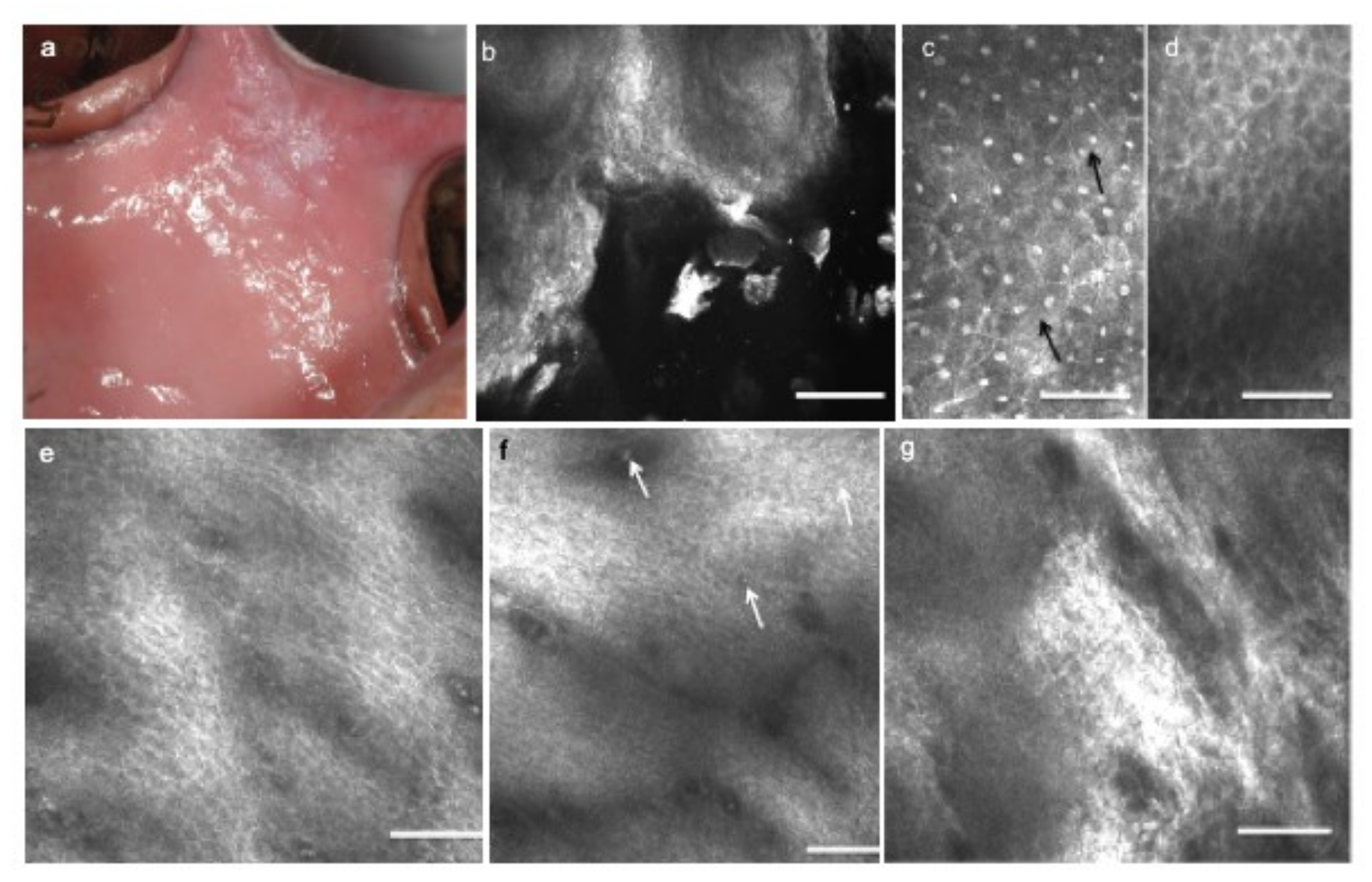 Cancers 13 02864 g006