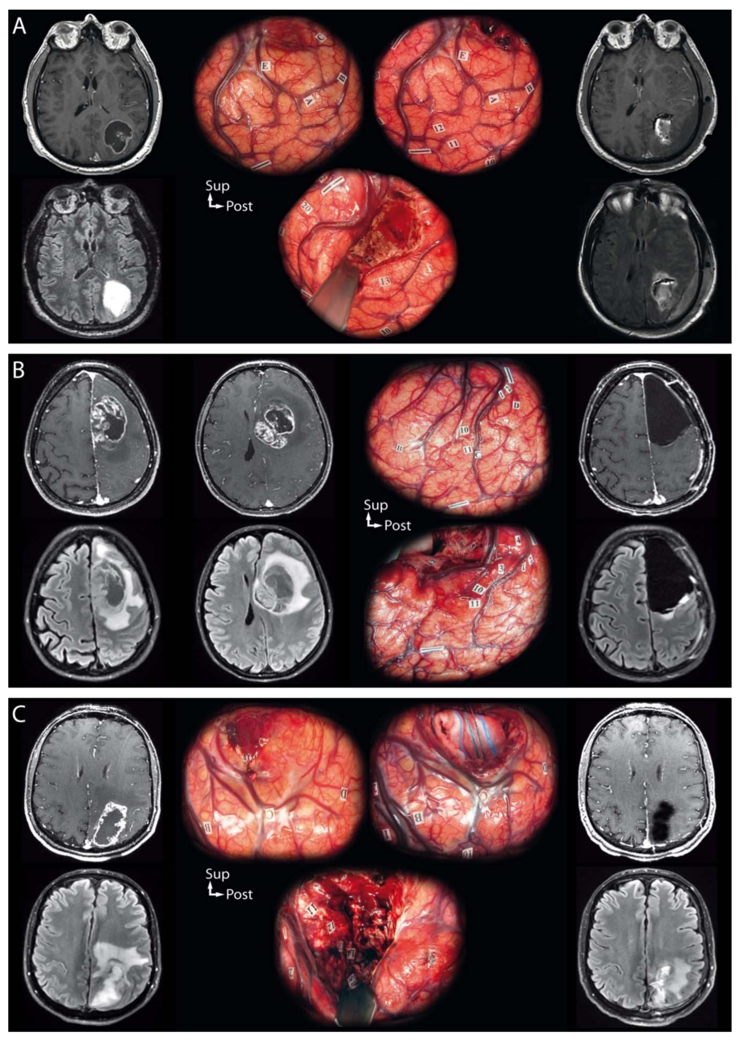 Cancers 13 02911 g002 Cancers 13 02911 g002