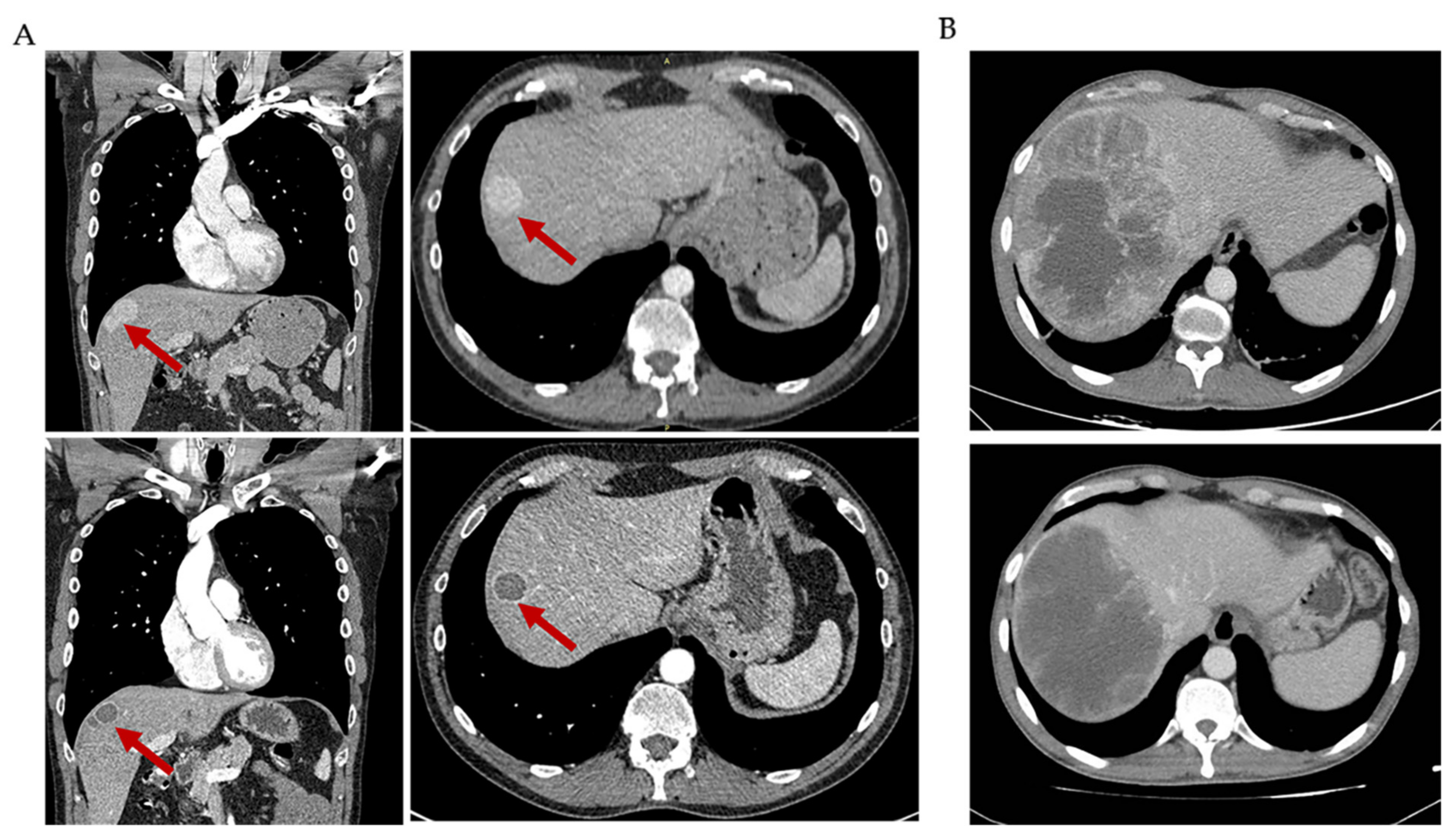 Cancers 13 02913 g003 Cancers 13 02913 g003