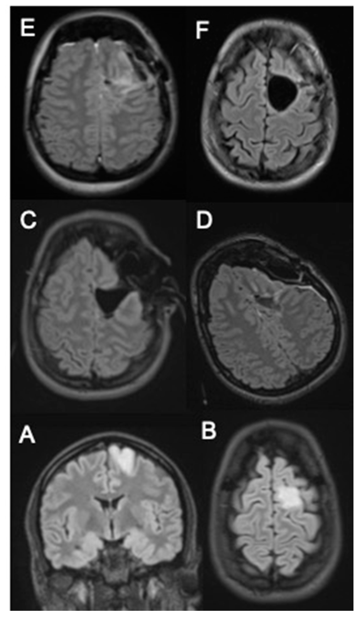 Cancers 13 02914 g004