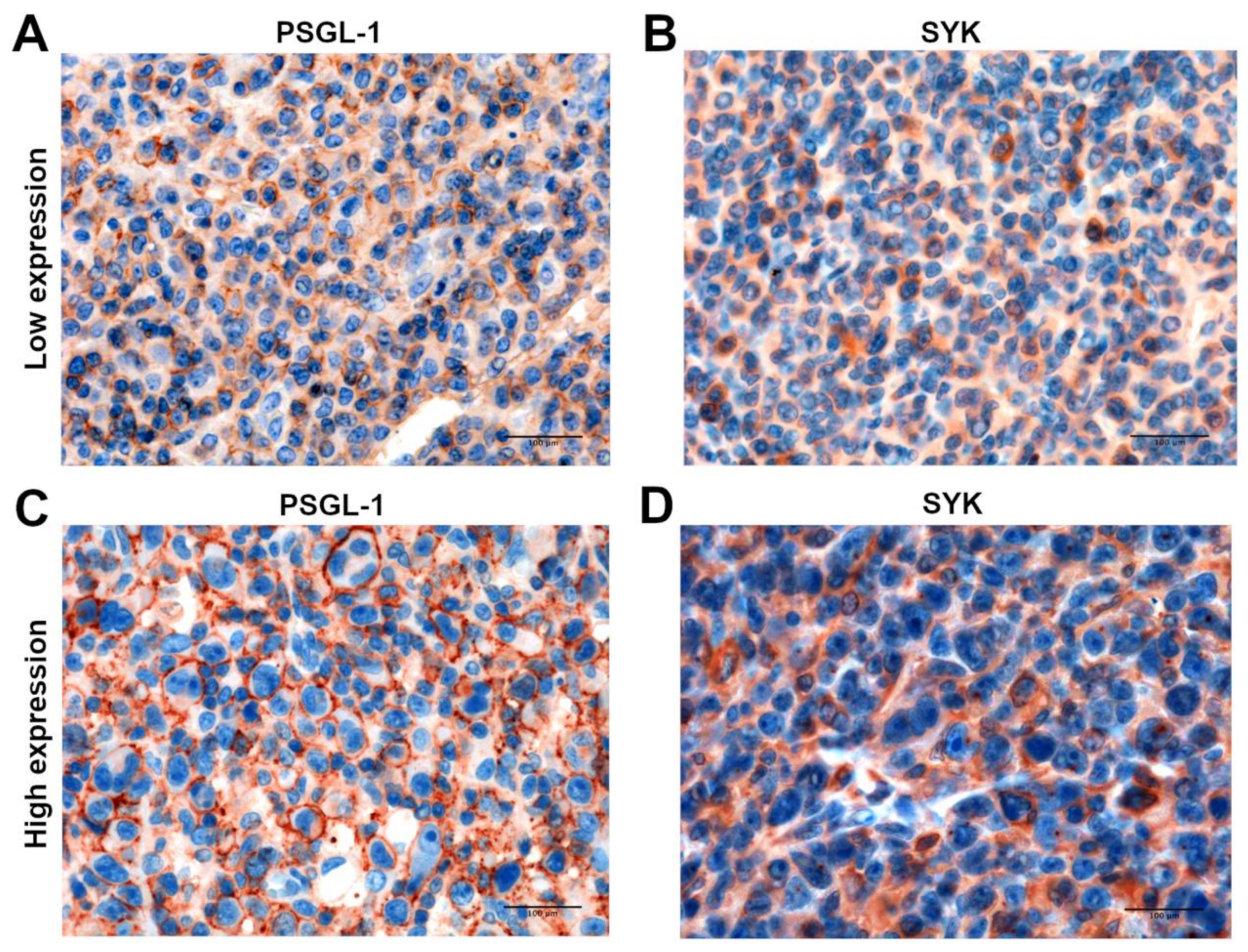 Cancers 13 02958 g005 Cancers 13 02958 g005