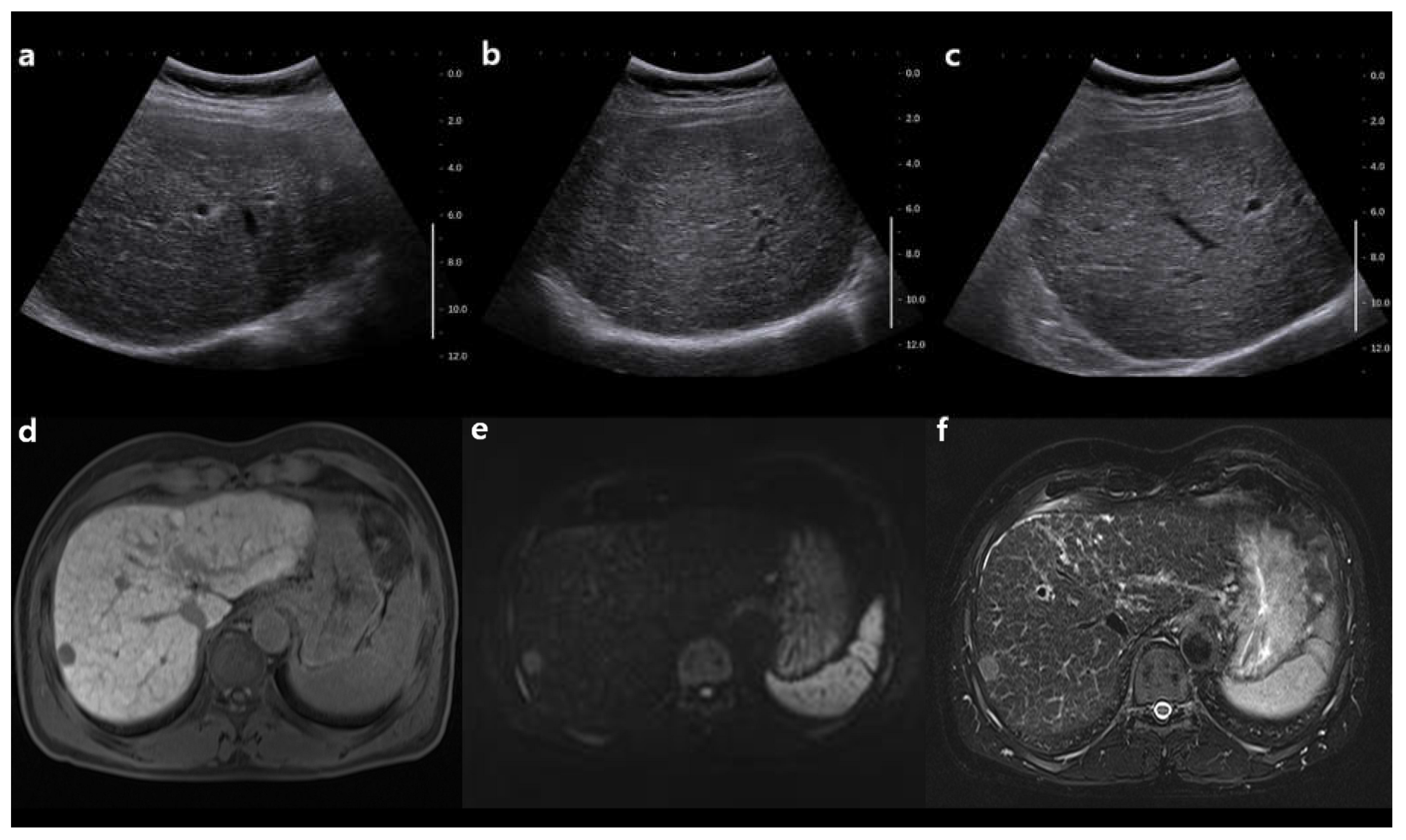 Cancers 13 02975 g003