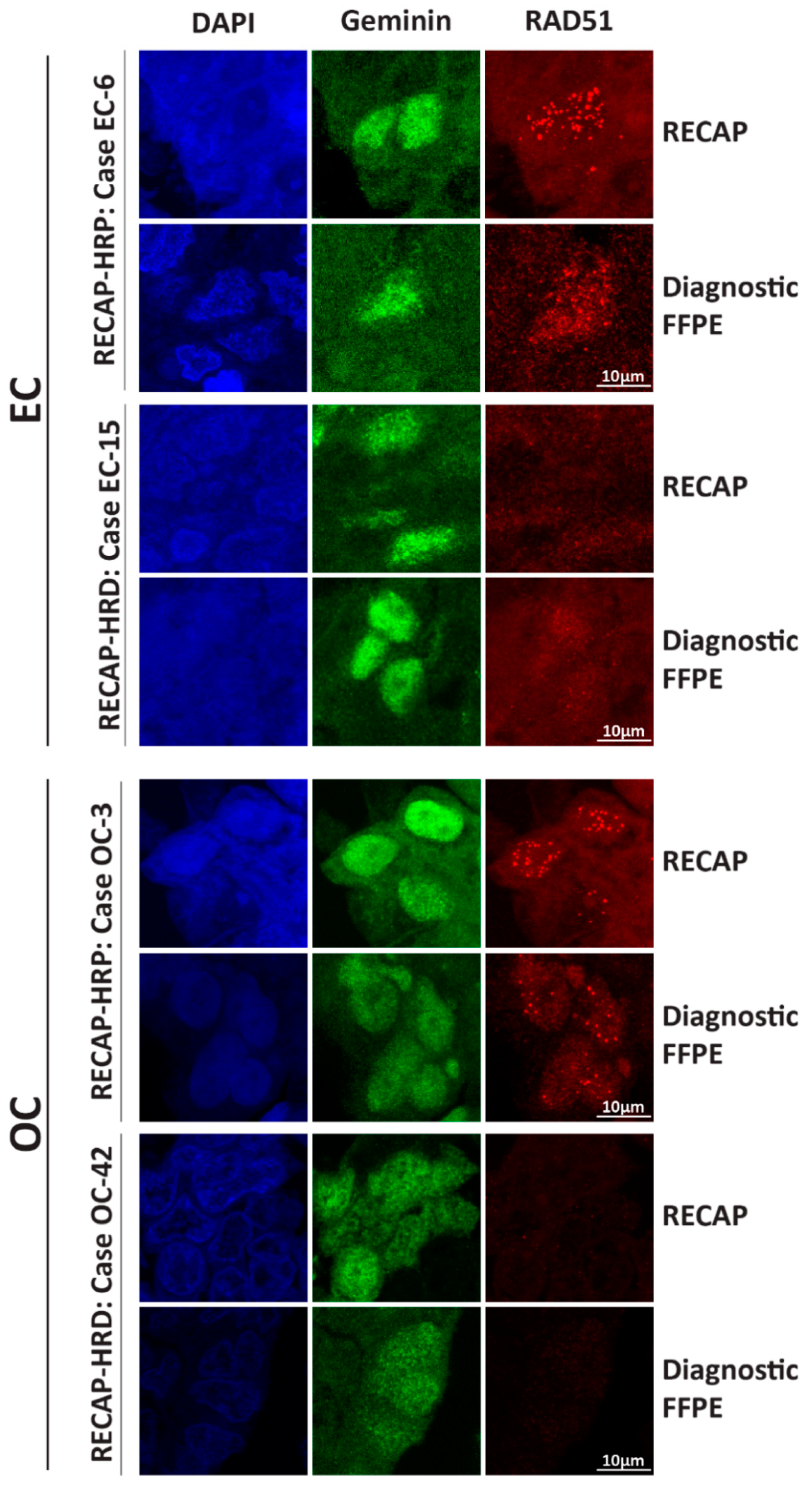 Cancers 13 02994 g003 Cancers 13 02994 g003