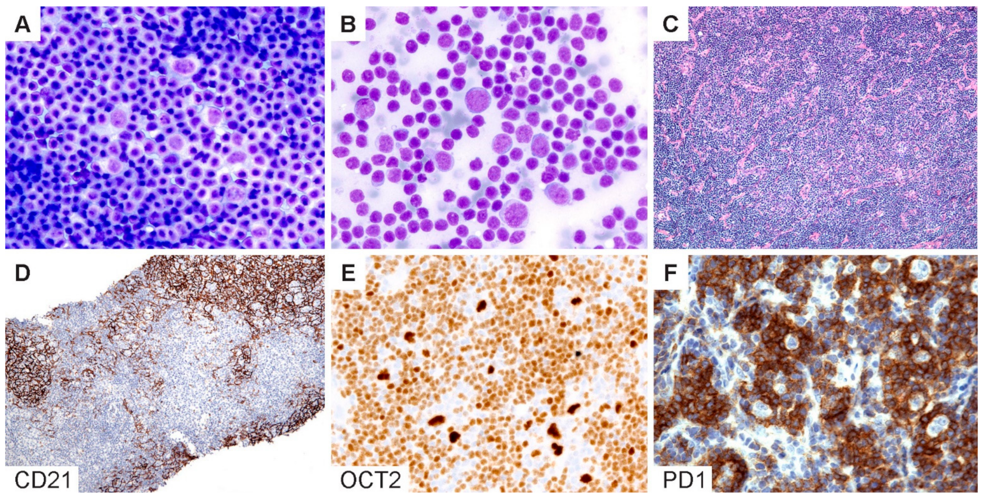 Cancers 13 03021 g006