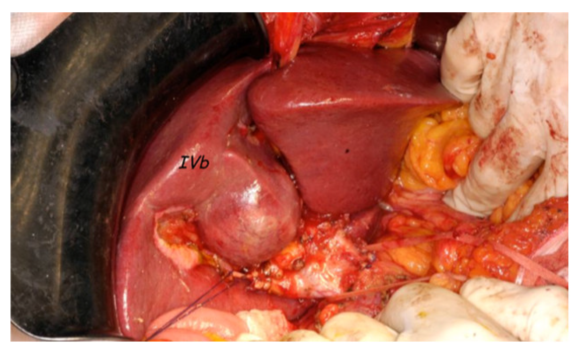 Cancers 13 03025 g003