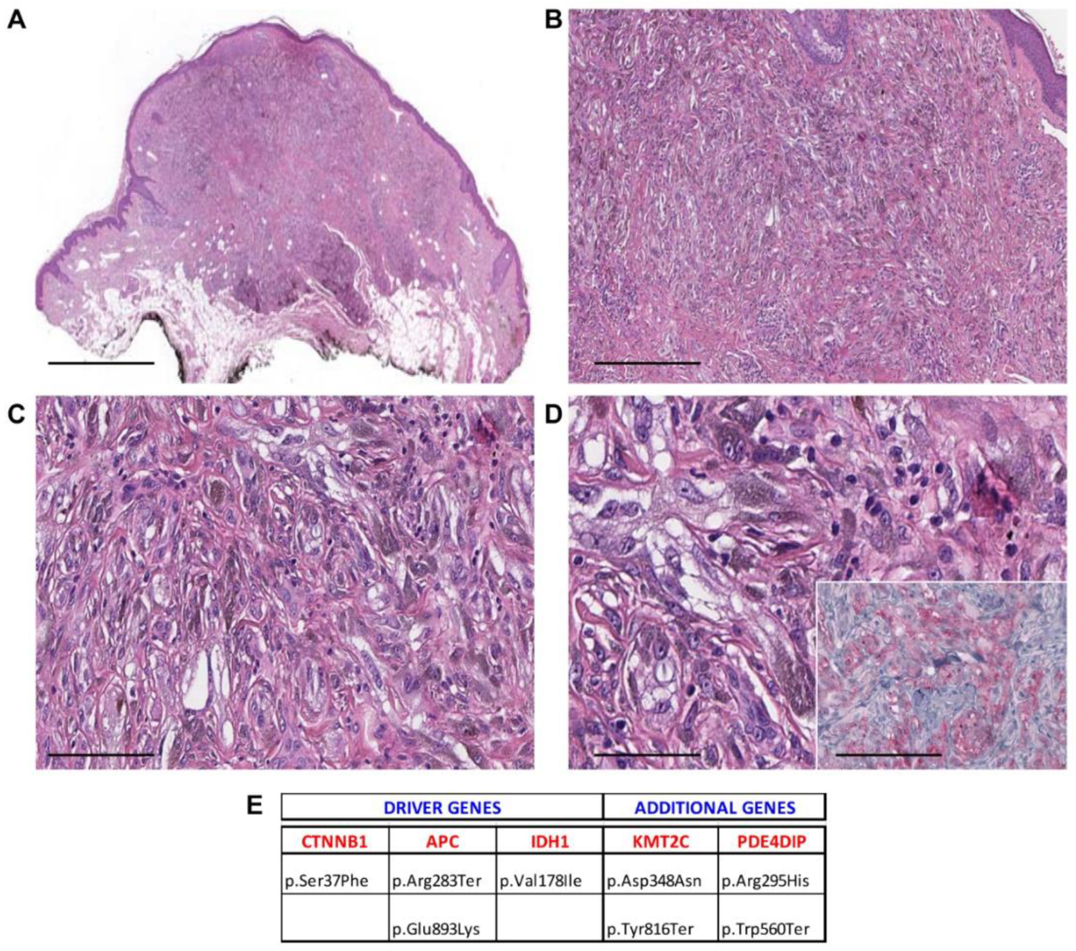 Cancers 13 03066 g004