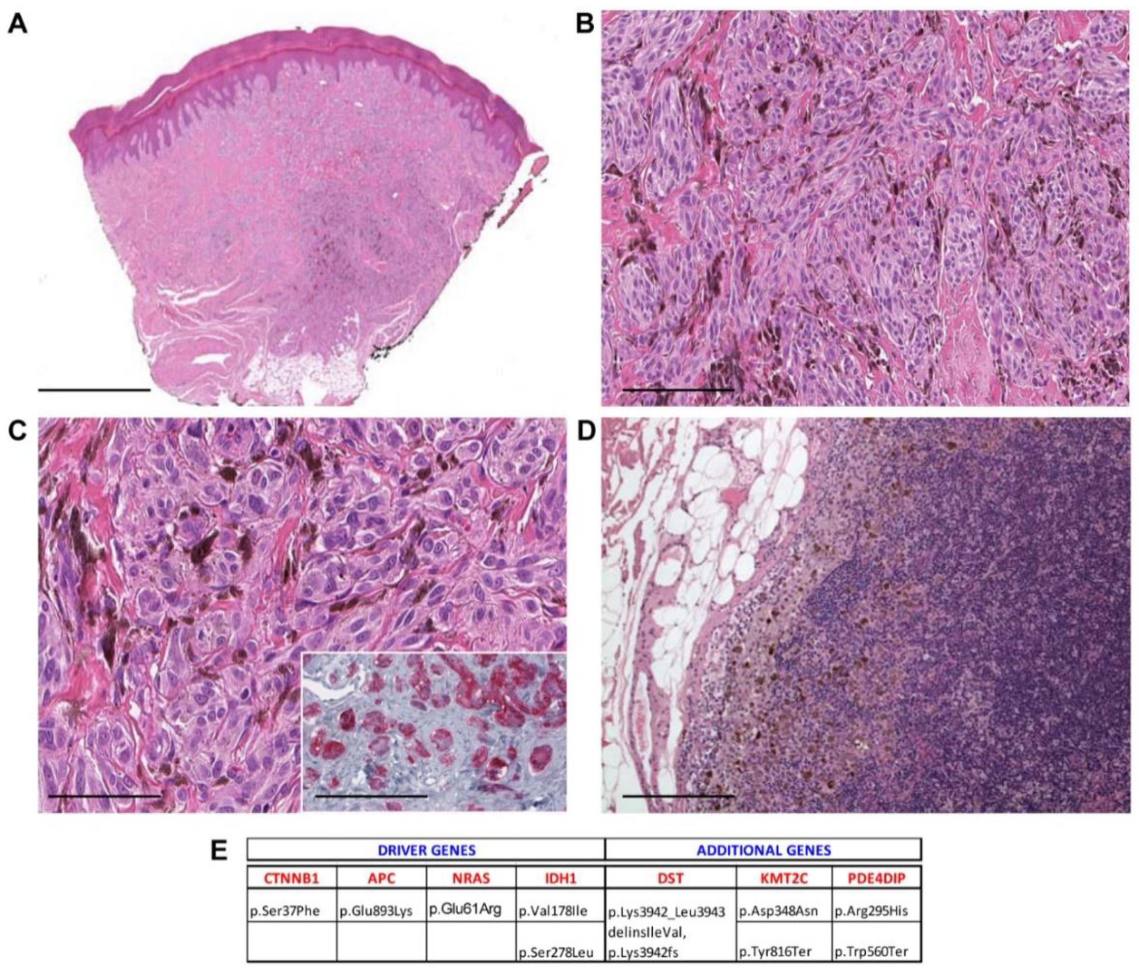 Cancers 13 03066 g005