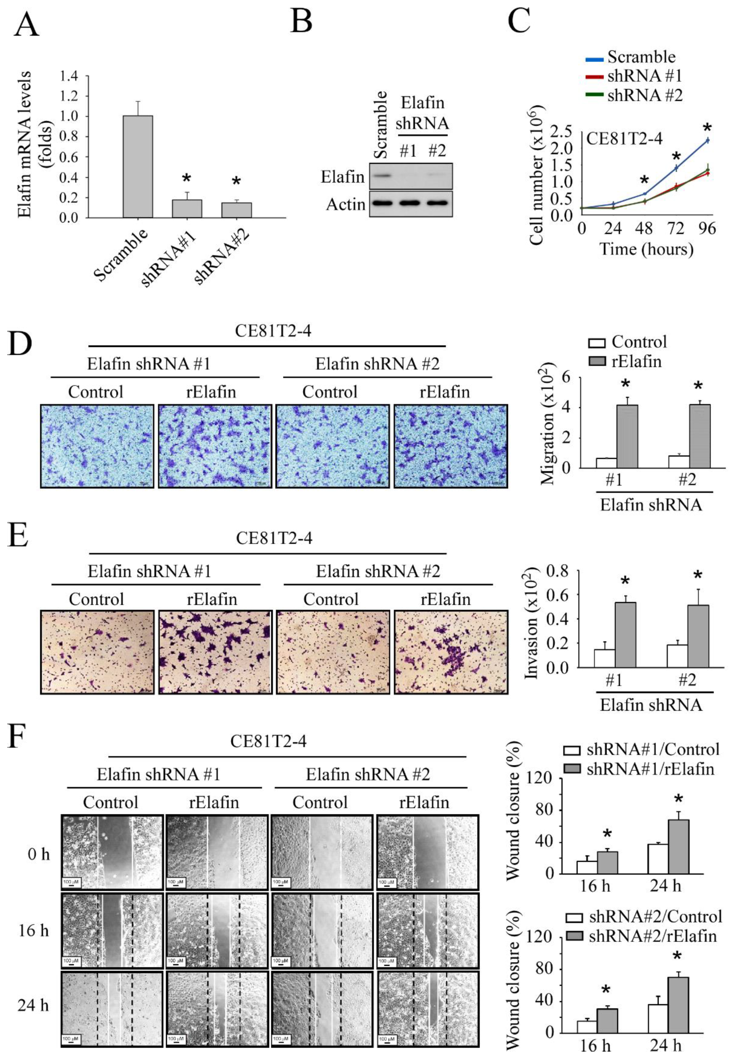 Cancers 13 03082 g004