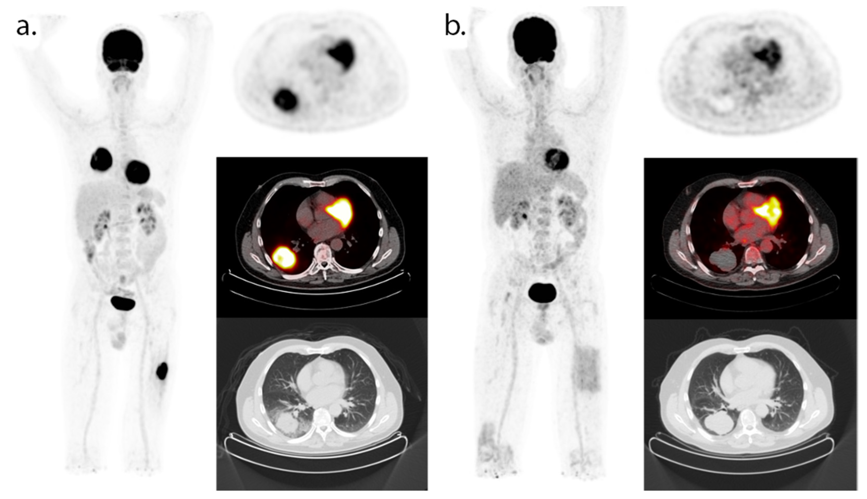 Cancers 13 03083 g002 550