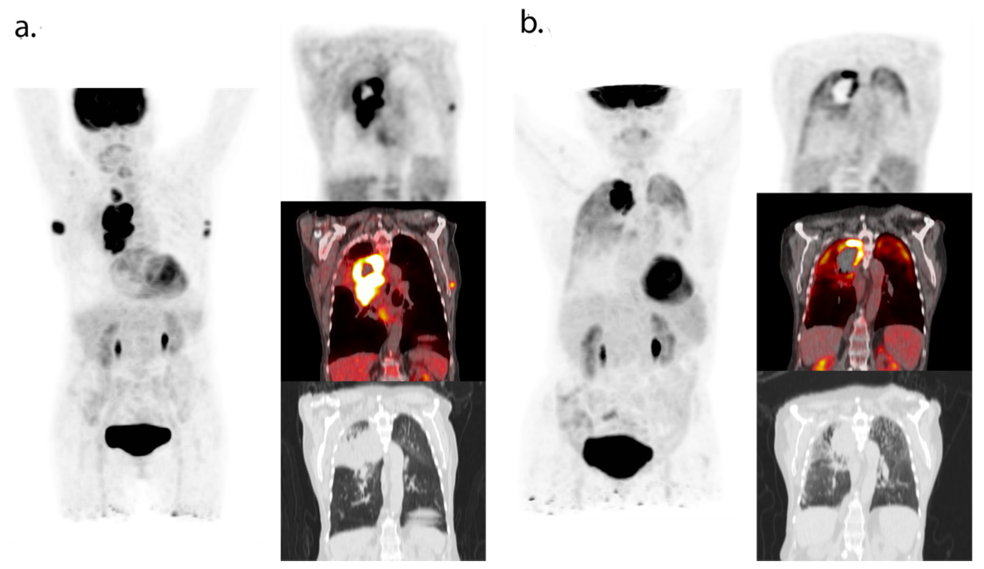 Cancers 13 03083 g003 550