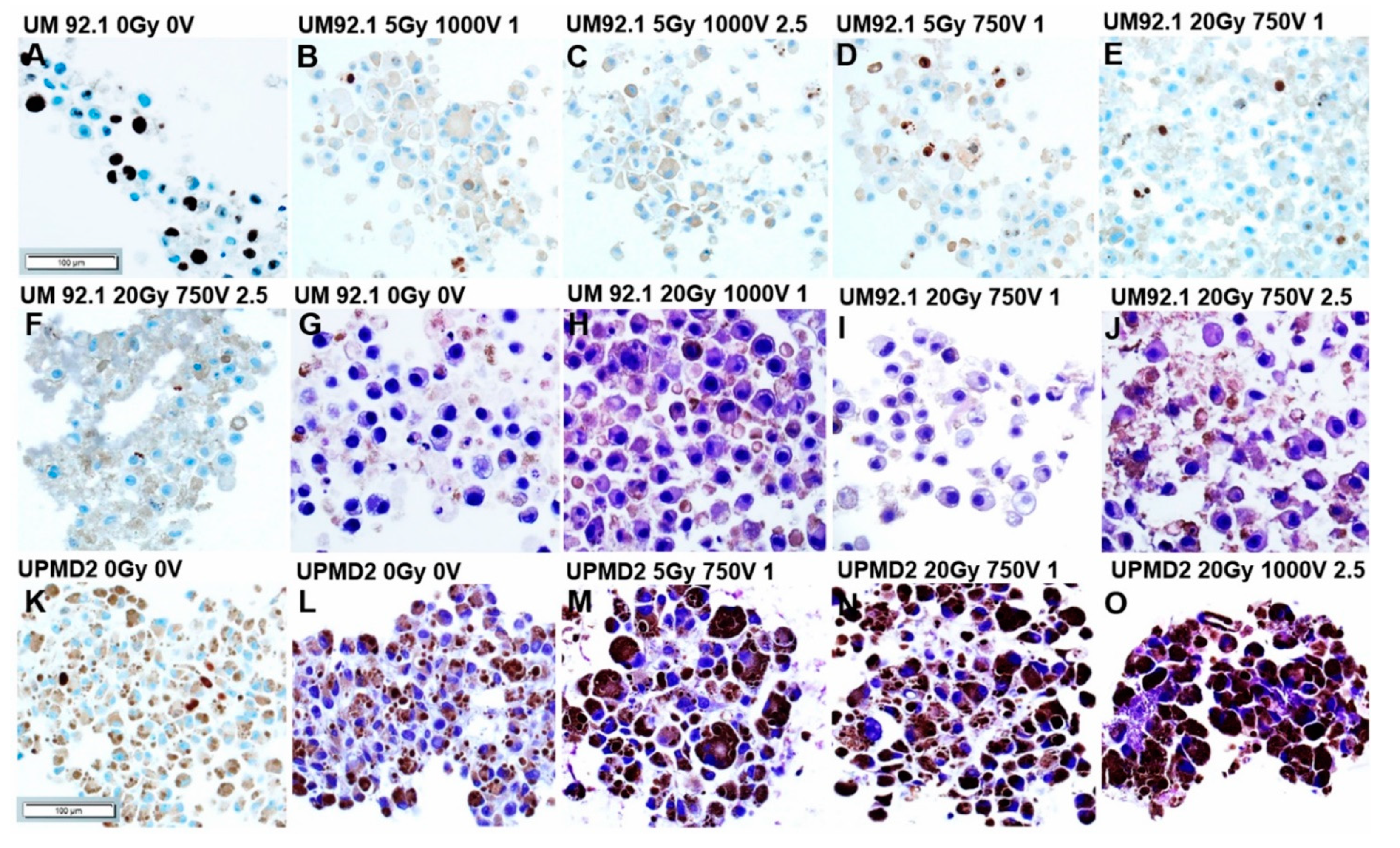 Cancers 13 03086 g003 Cancers 13 03086 g003
