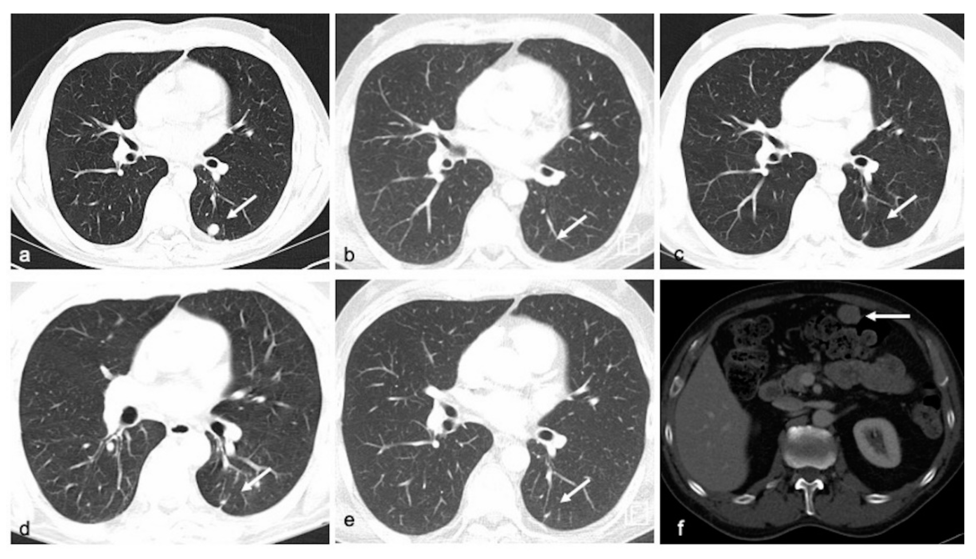 Cancers 13 03101 g007