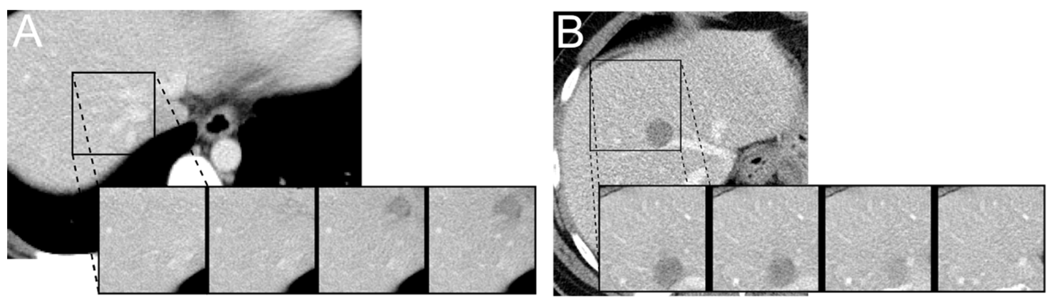 Cancers 13 03108 g003