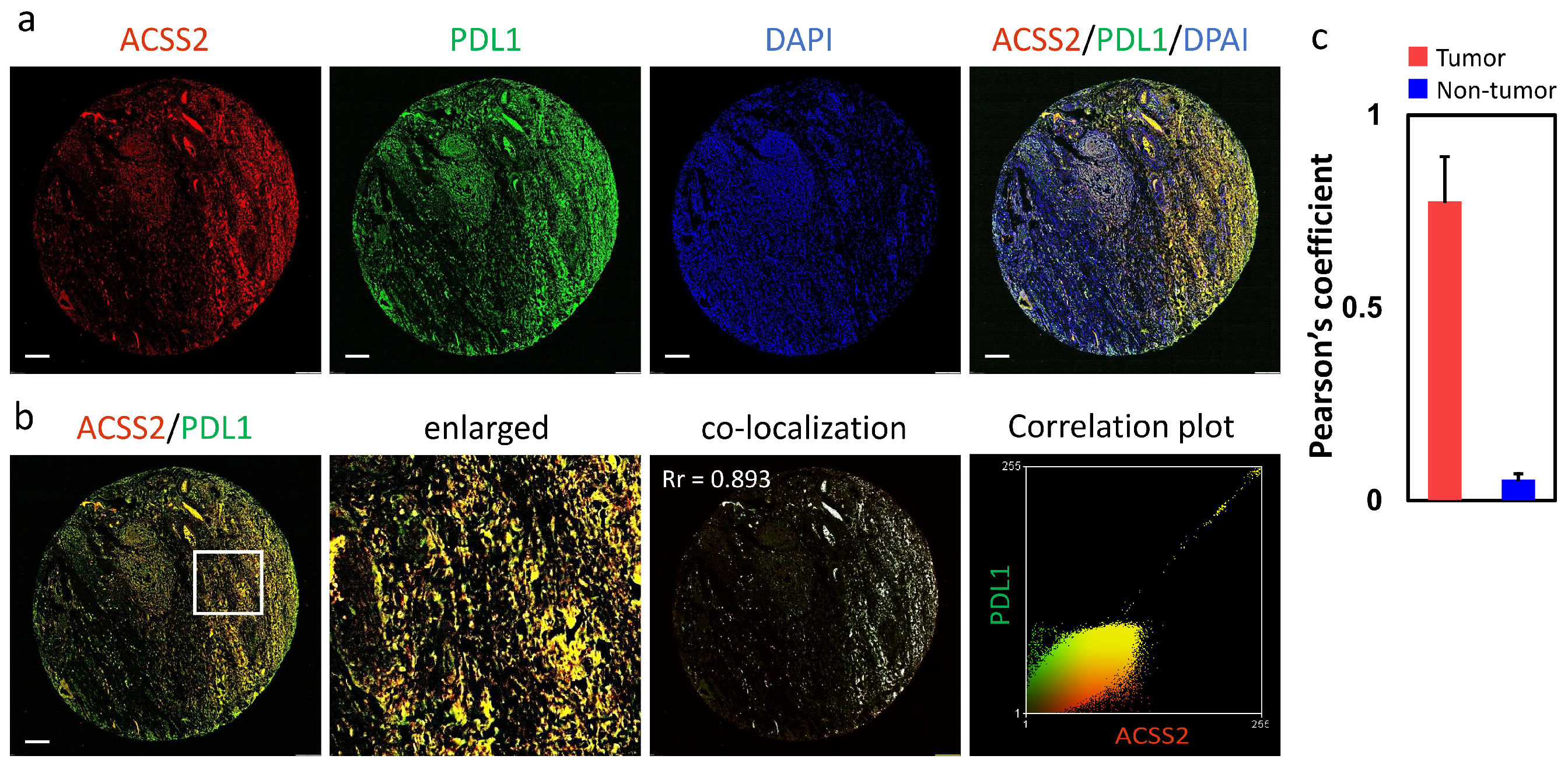 Cancers 13 03125 g006