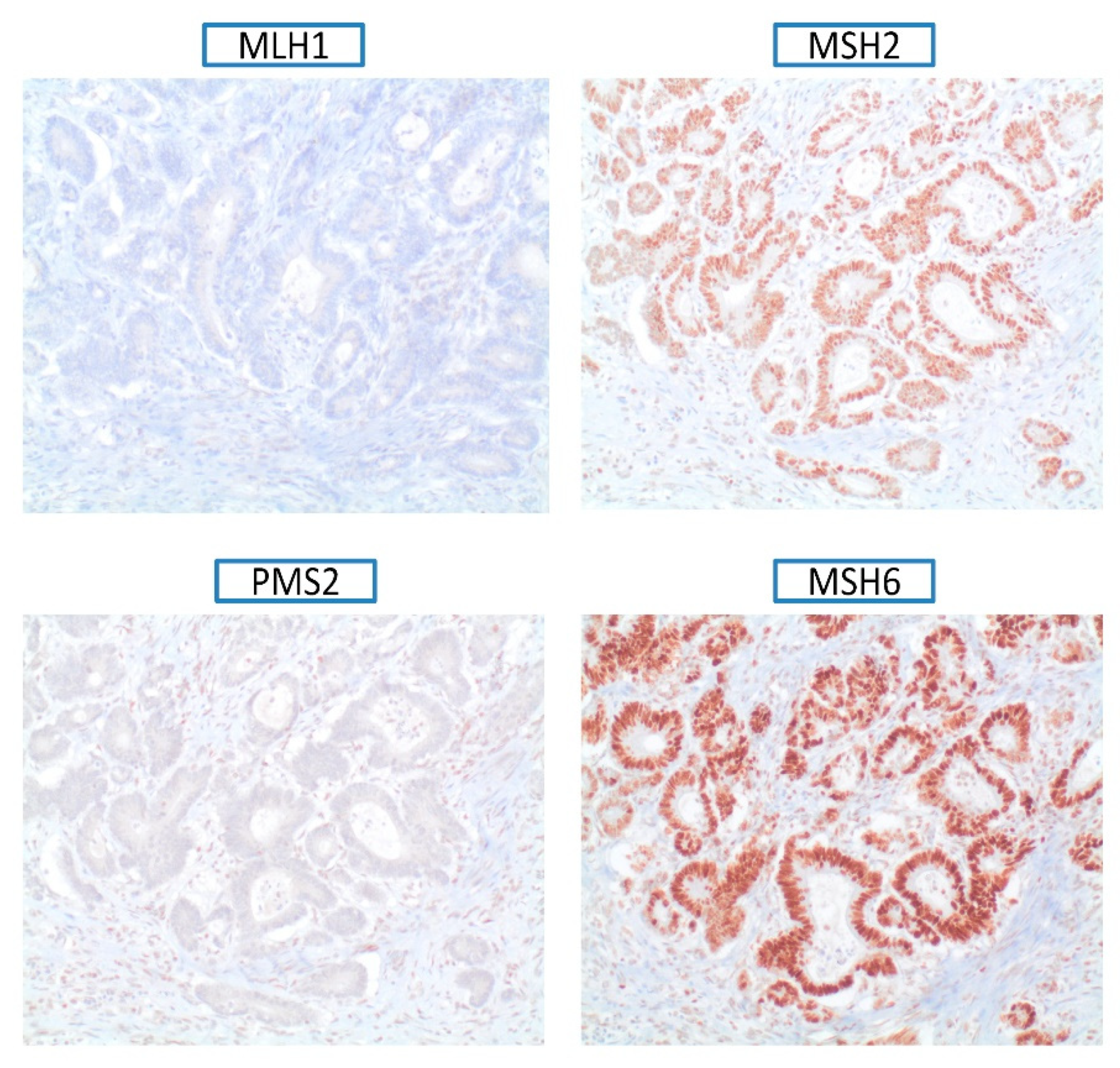 Cancers 13 03132 g001 550