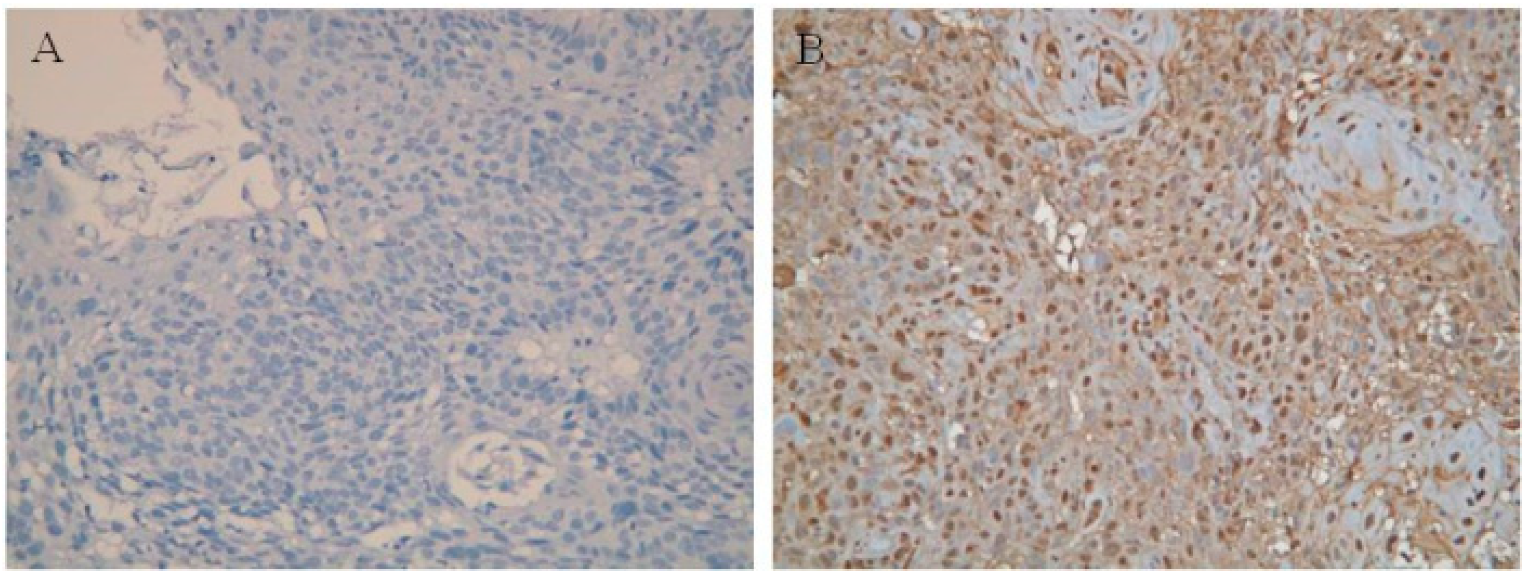 Cancers 13 03147 g001