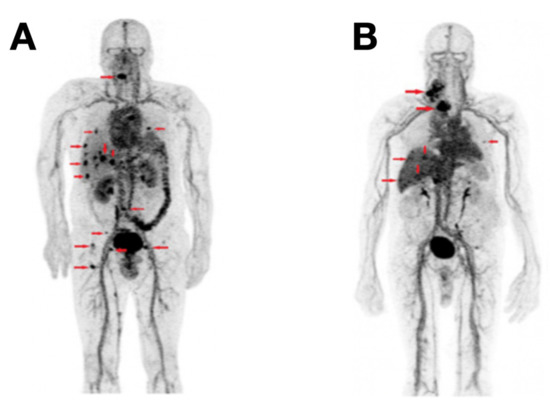 Next-Generation Molecular Imaging of Thyroid Cancer
