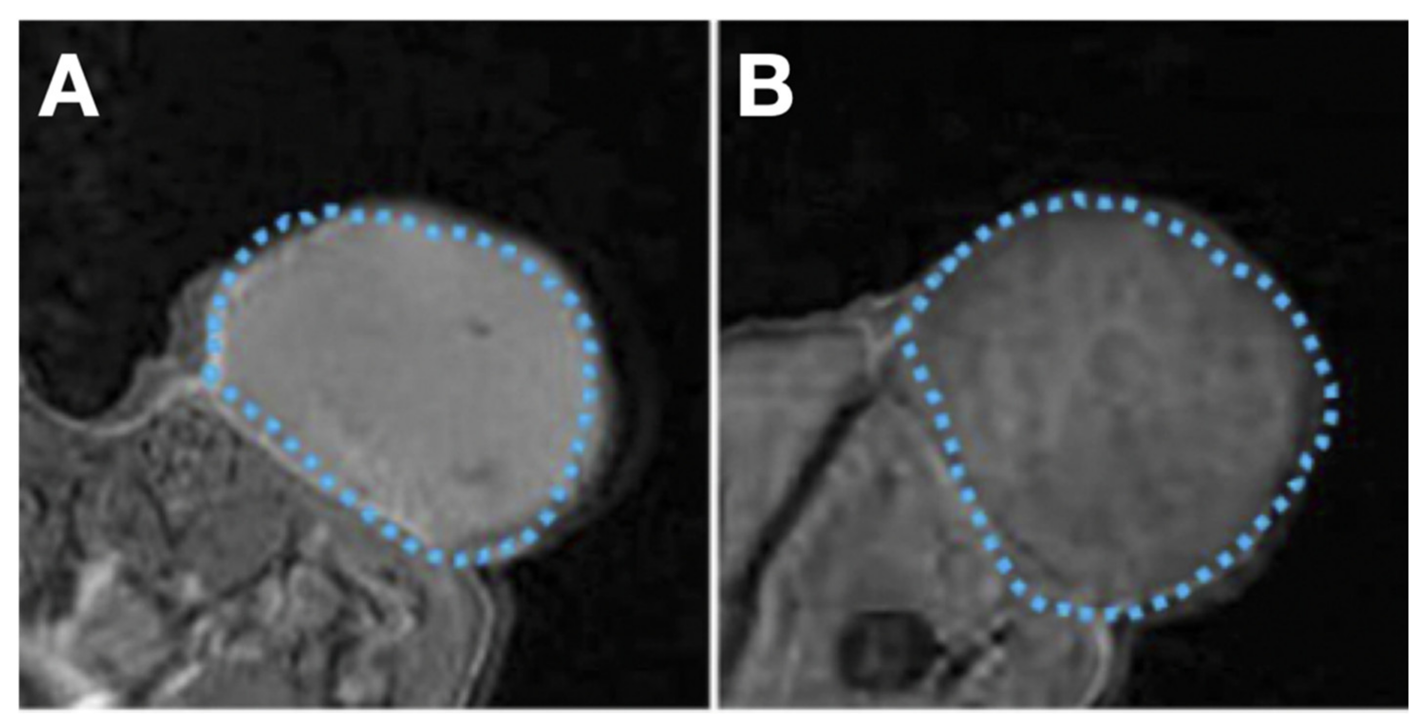 Cancers 13 03188 g016