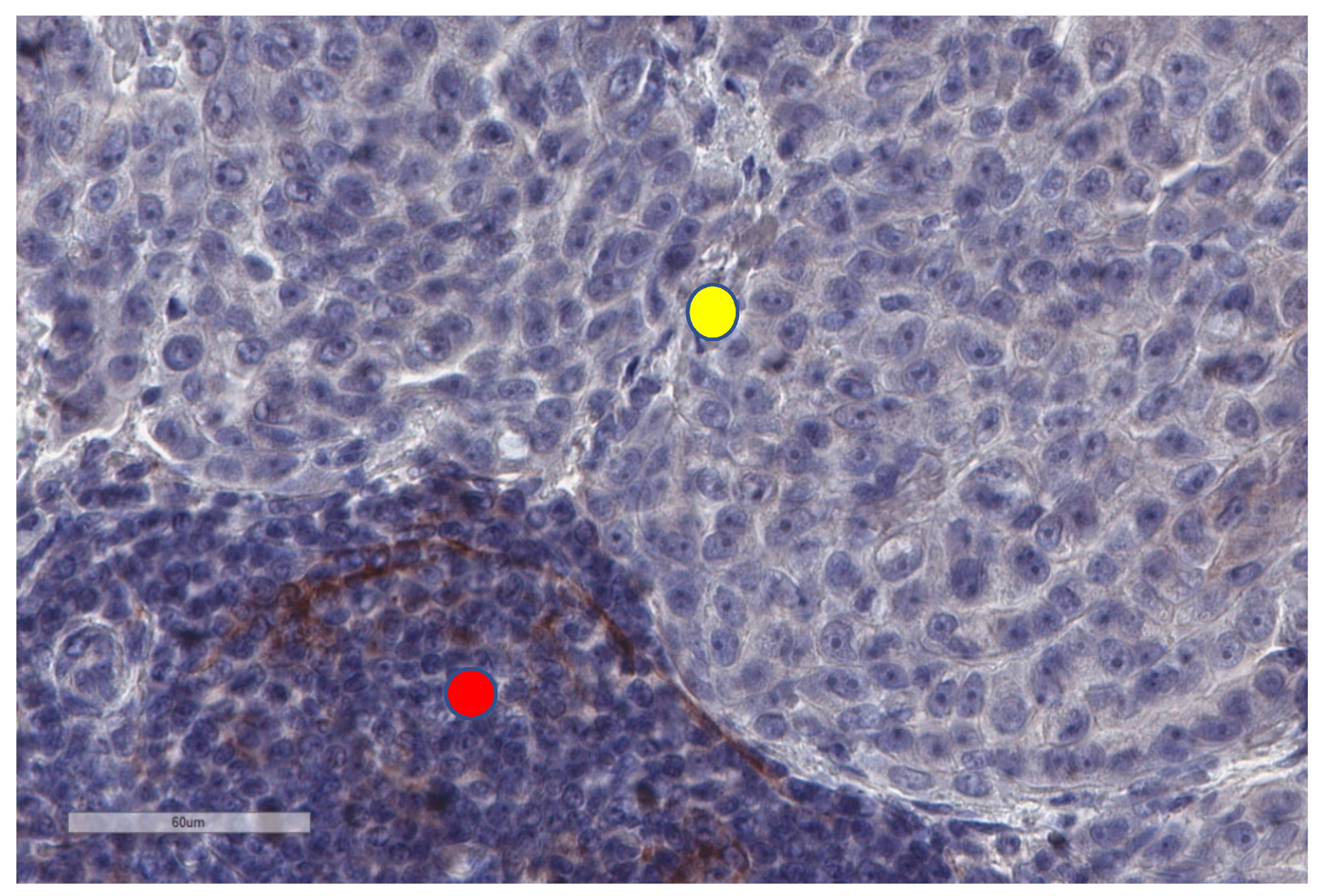 will a pet scan show cancer in bones