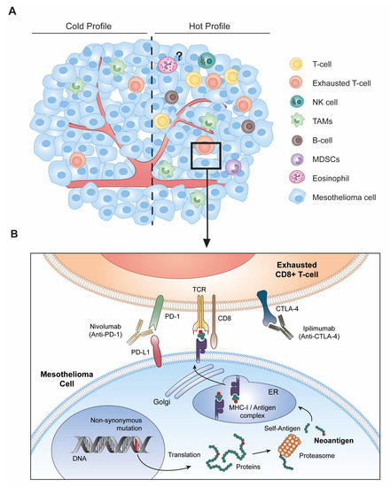 malignant mesothelioma stages