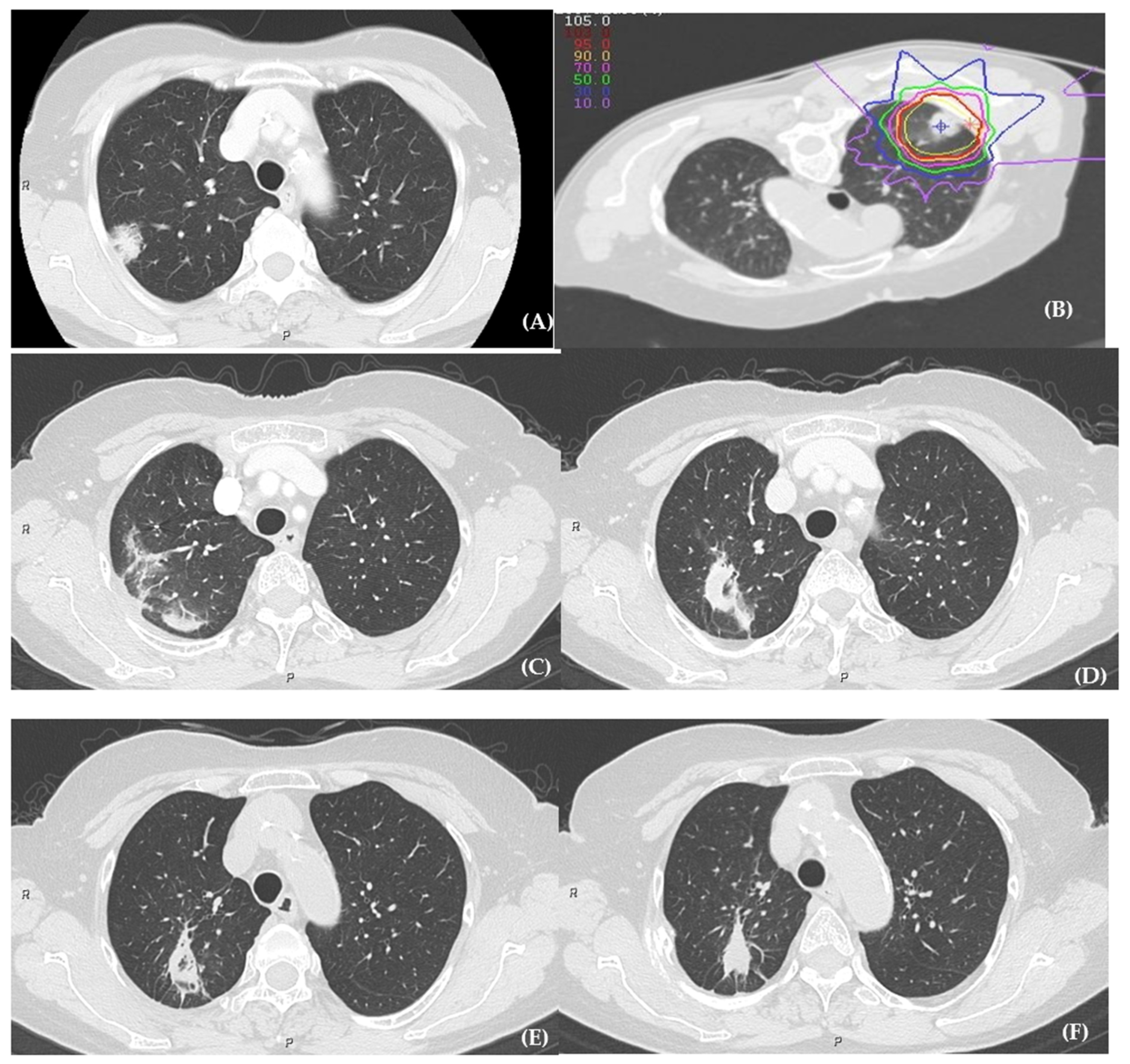 Cancers 13 03229 g001