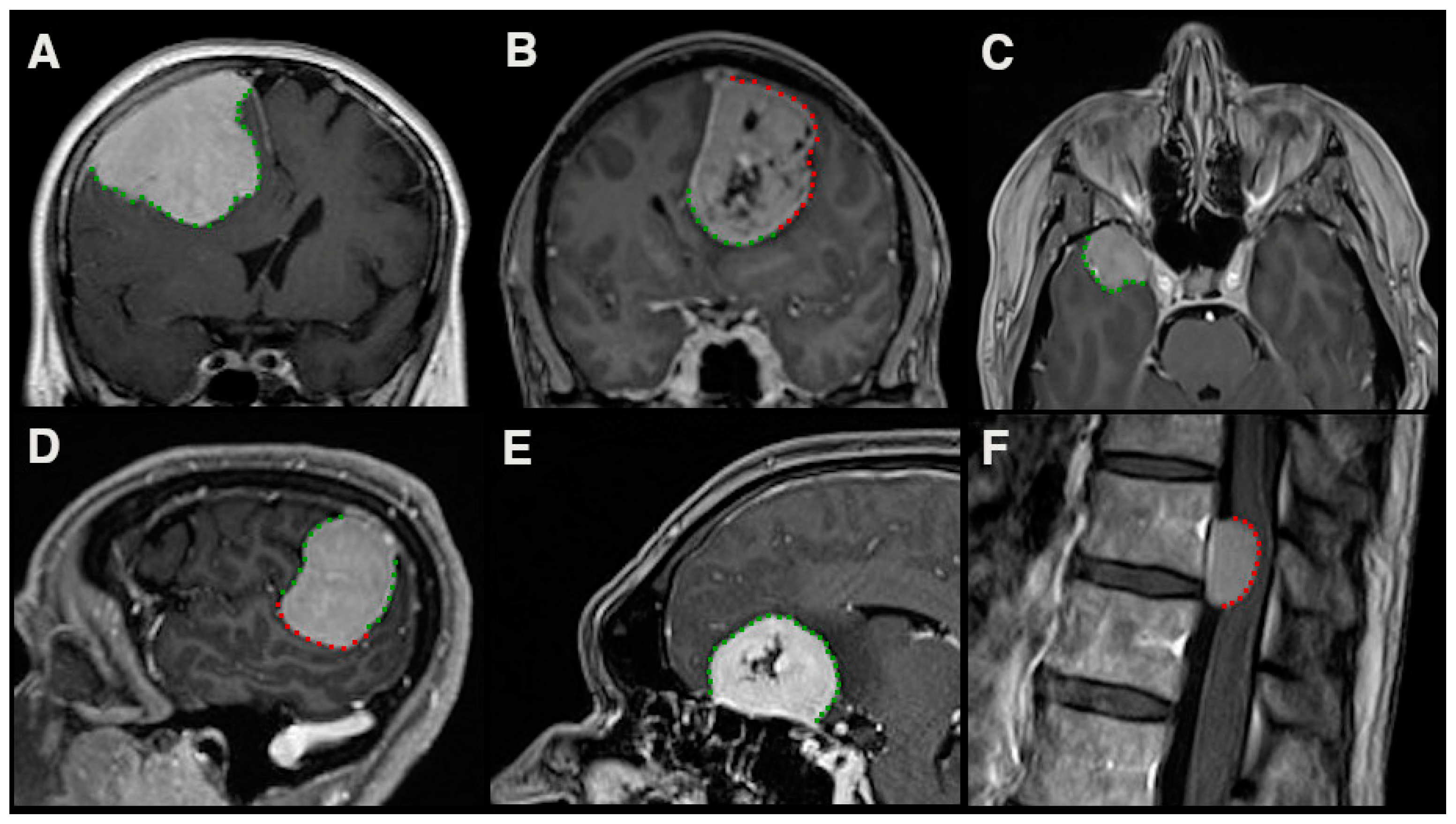 Cancers 13 03259 g002 550