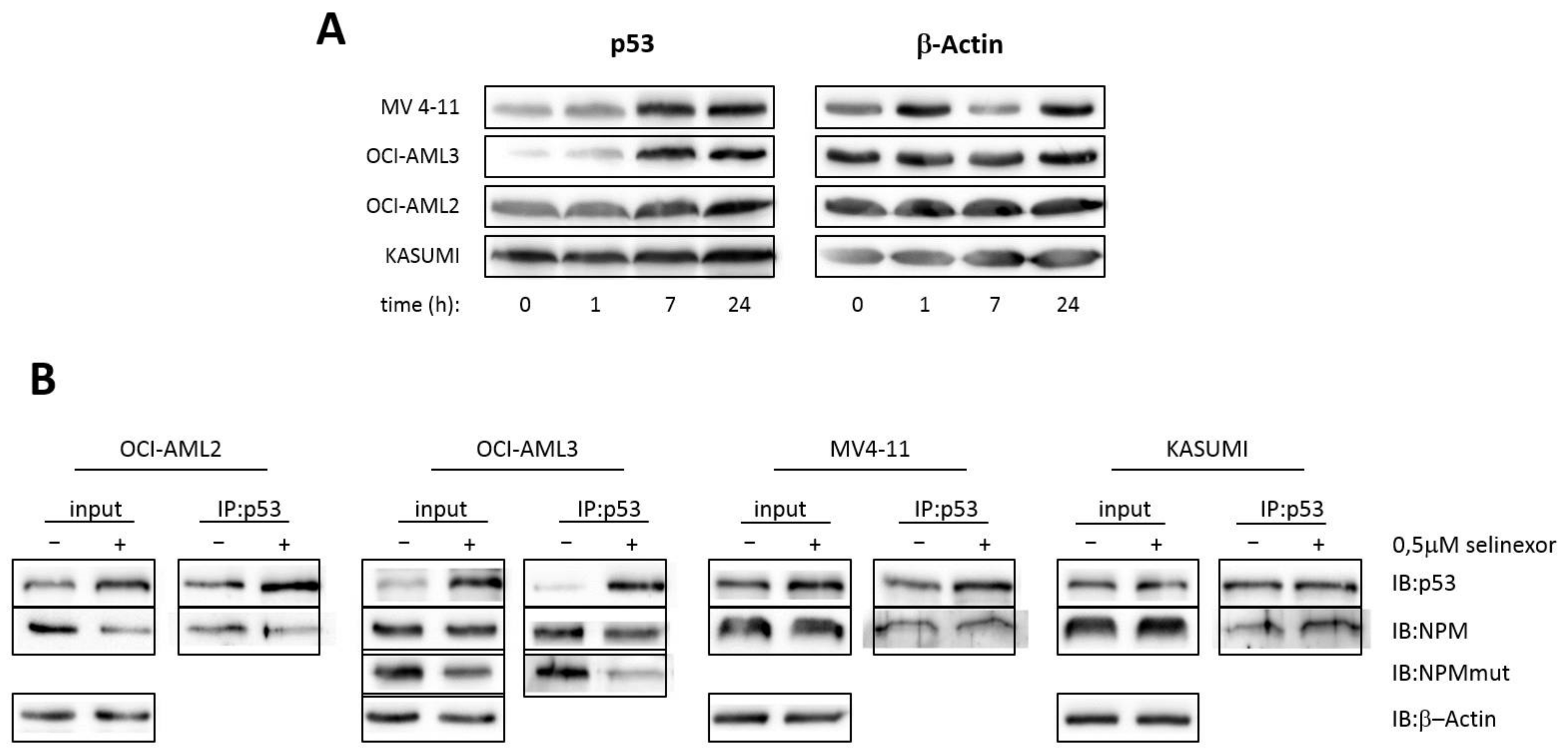 Cancers 13 03266 g011