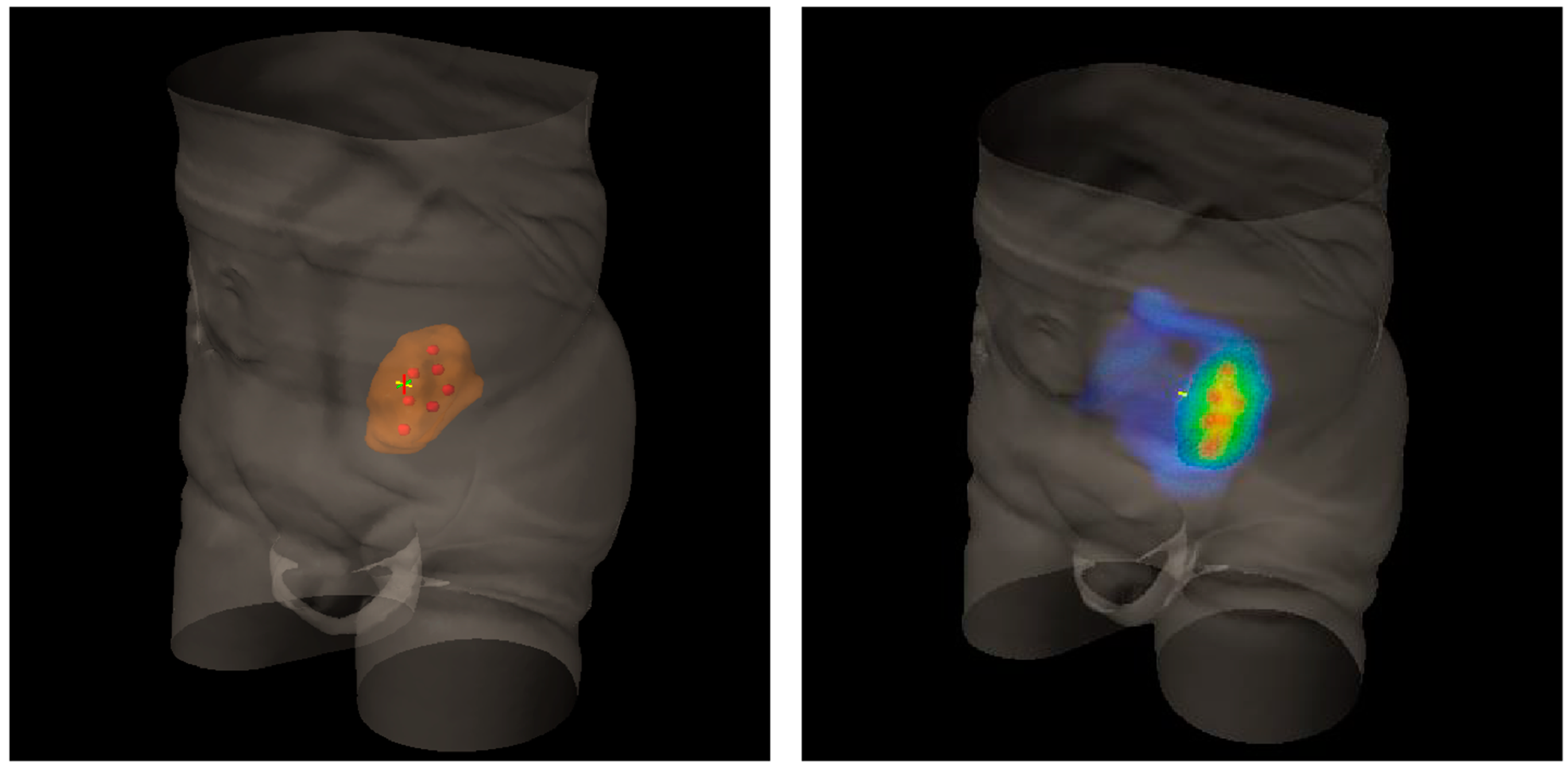 Cancers 13 03290 g002 Cancers 13 03290 g002