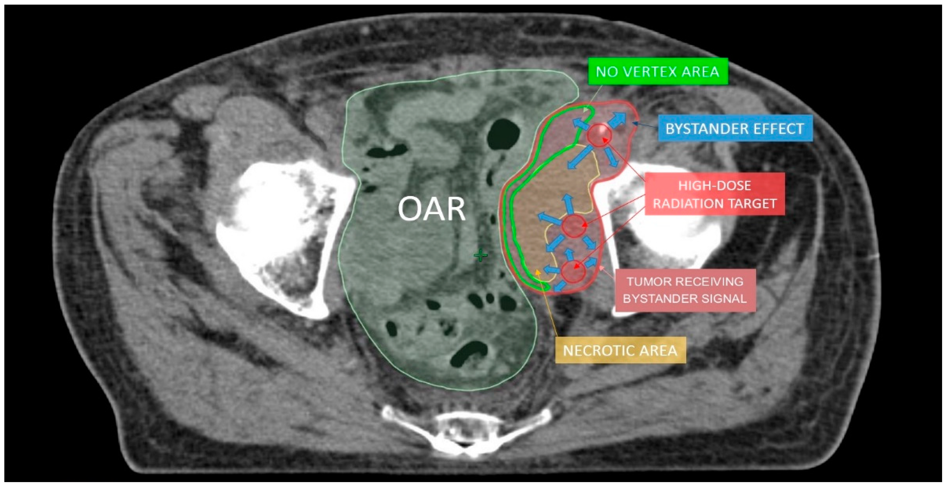 Cancers 13 03290 g004 Cancers 13 03290 g004