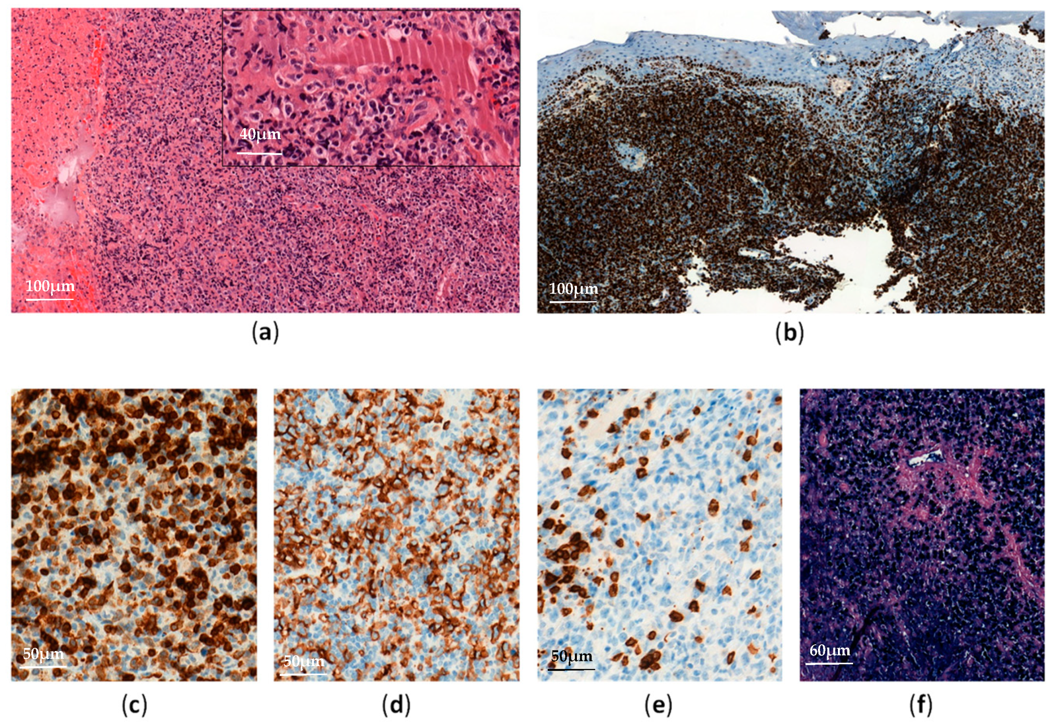 Cancers 13 03315 g003 Cancers 13 03315 g003