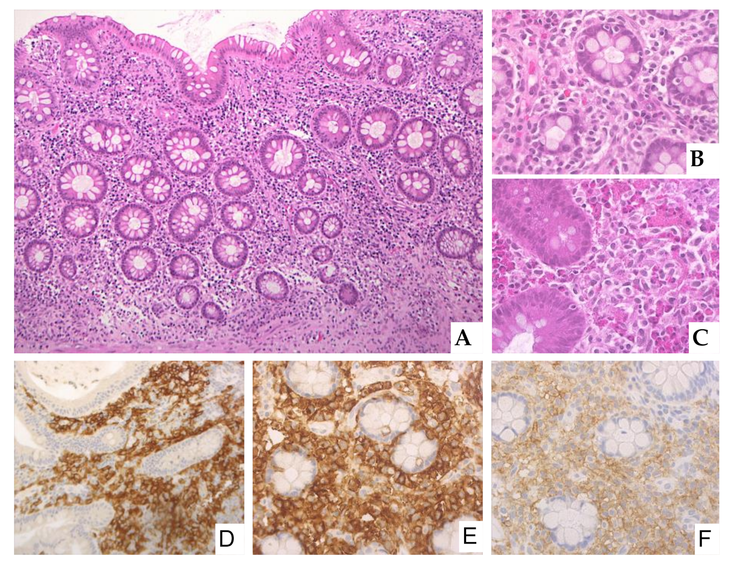 Cancers 13 03316 g001