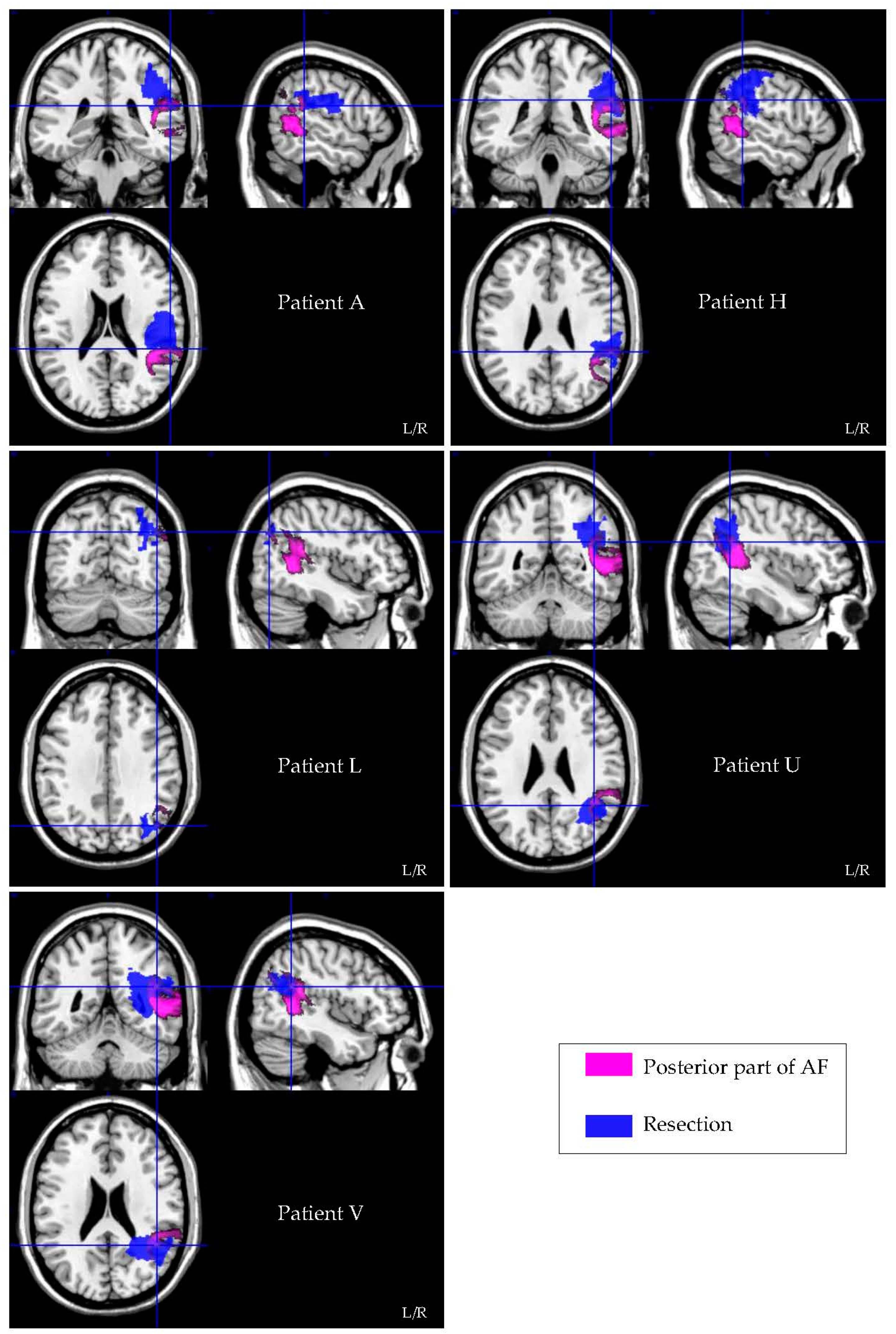 Cancers 13 03337 g002